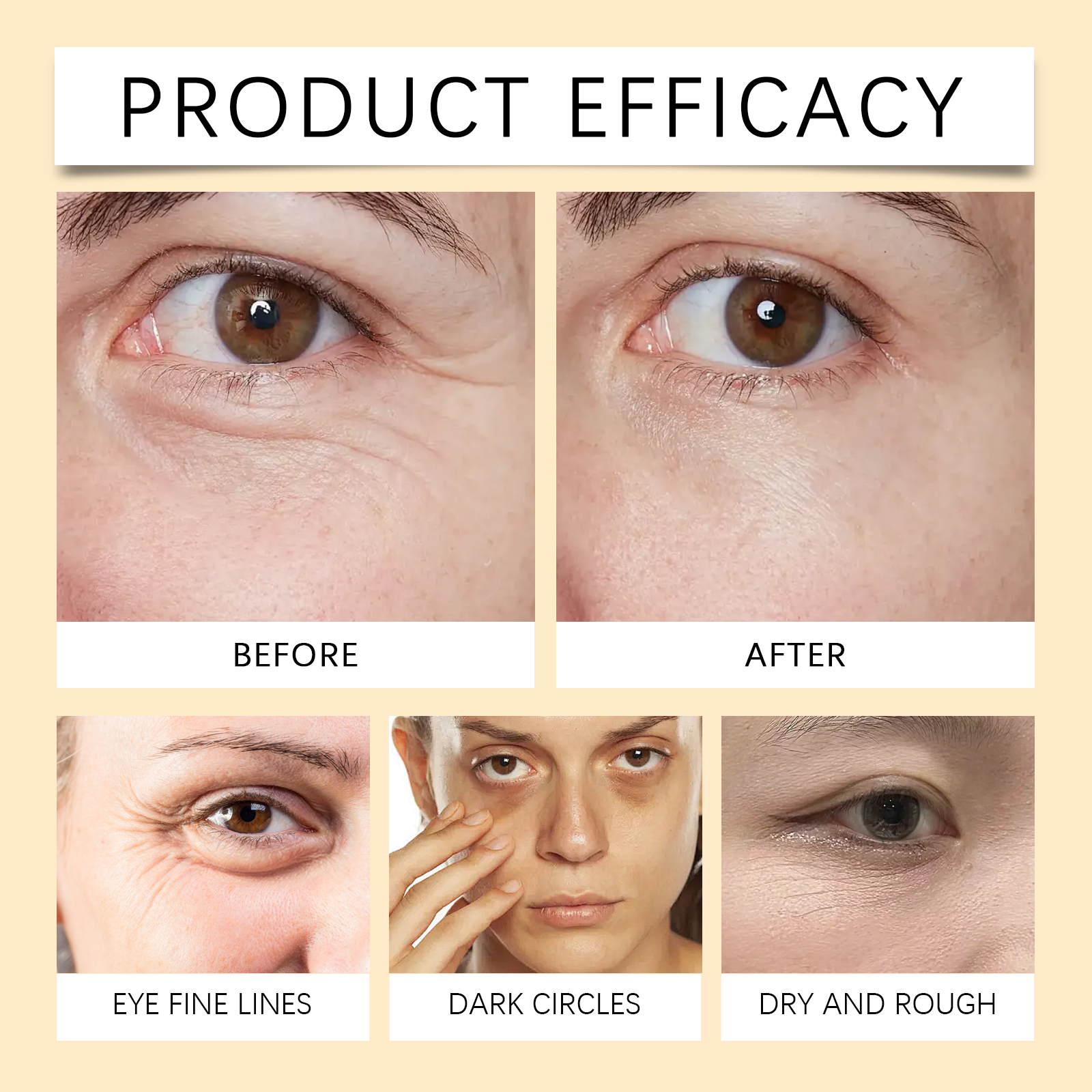 Moisturizing Eye Essence Oil Gentle Nourish Improve Fine Lines Hydrate Soft Eye Care Essence