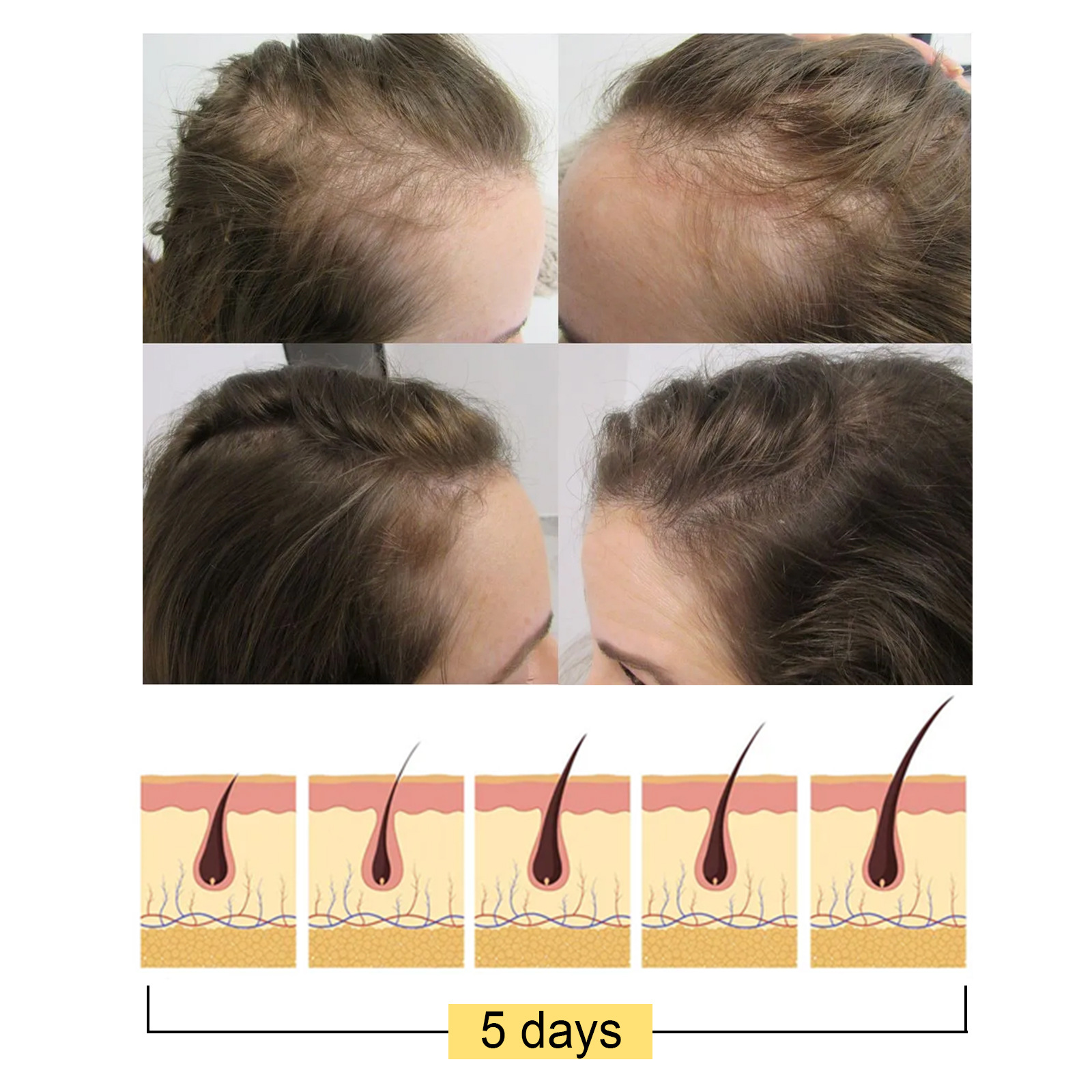 Rice Shampoo Bar Rice Soap For Hair Growth Fermented Rice Water Moisturizing Anti-Hair Loss For Women Men