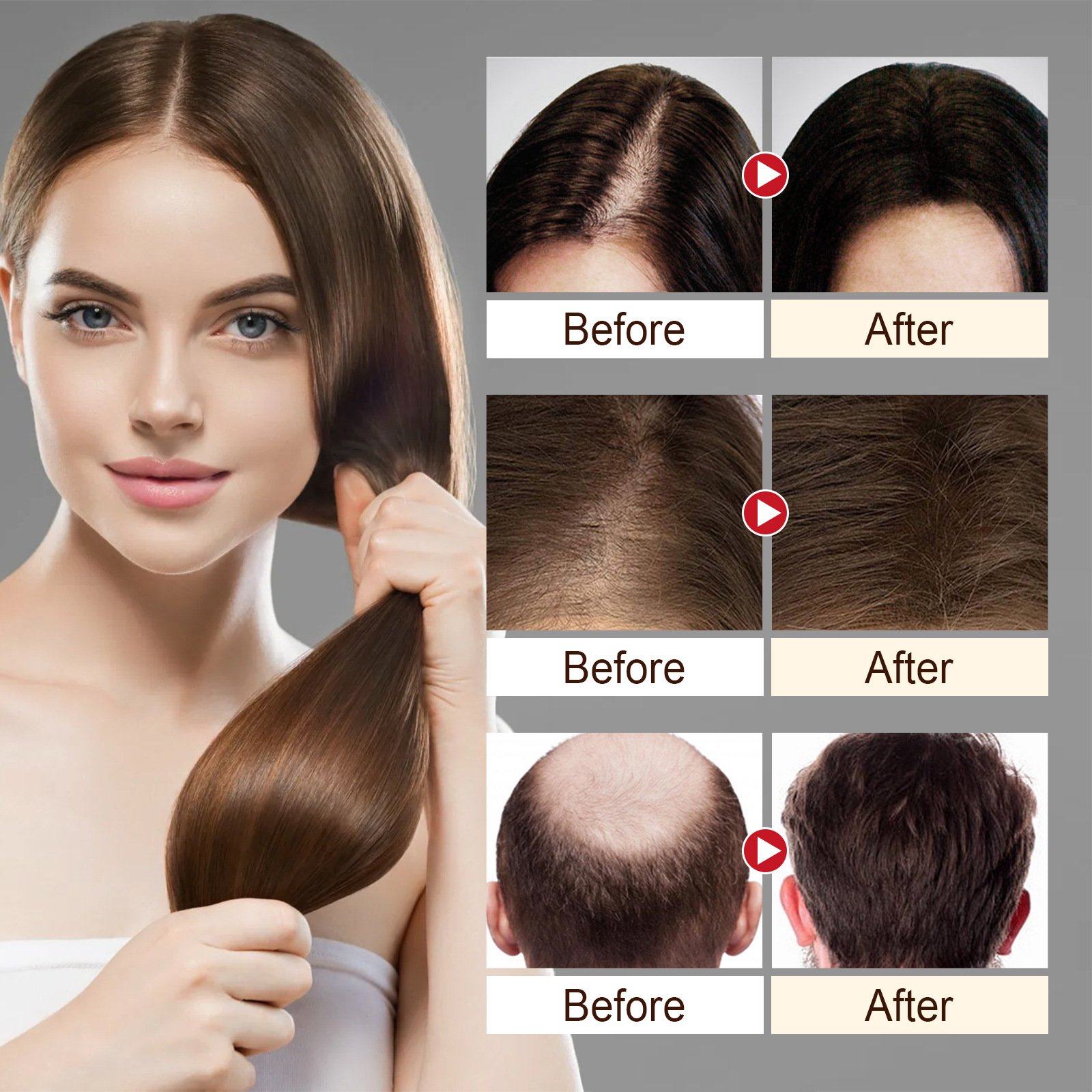 Hair Essence Rice Dense Hair Spray Hair Fast Growth Serum Snti-Hair Loss Seborrheic Hair Loss Repair Deep Care Hair Texture Man Woman 50ml