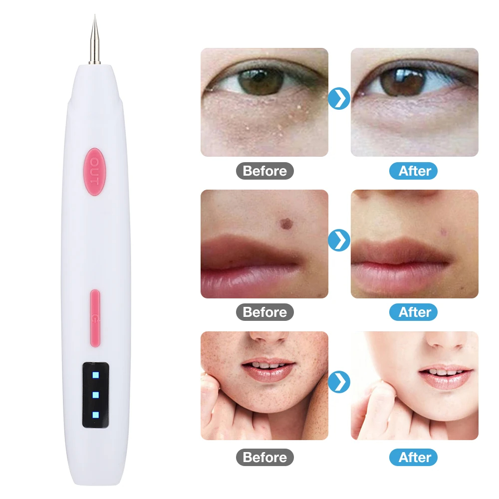 Freckle Remover Mini Mole Pen Black Dot Spots Fat Granules Pimples Tattoos Warts Skin Tag Removal Electric Laser Plasma Pen Beauty Tools Machine