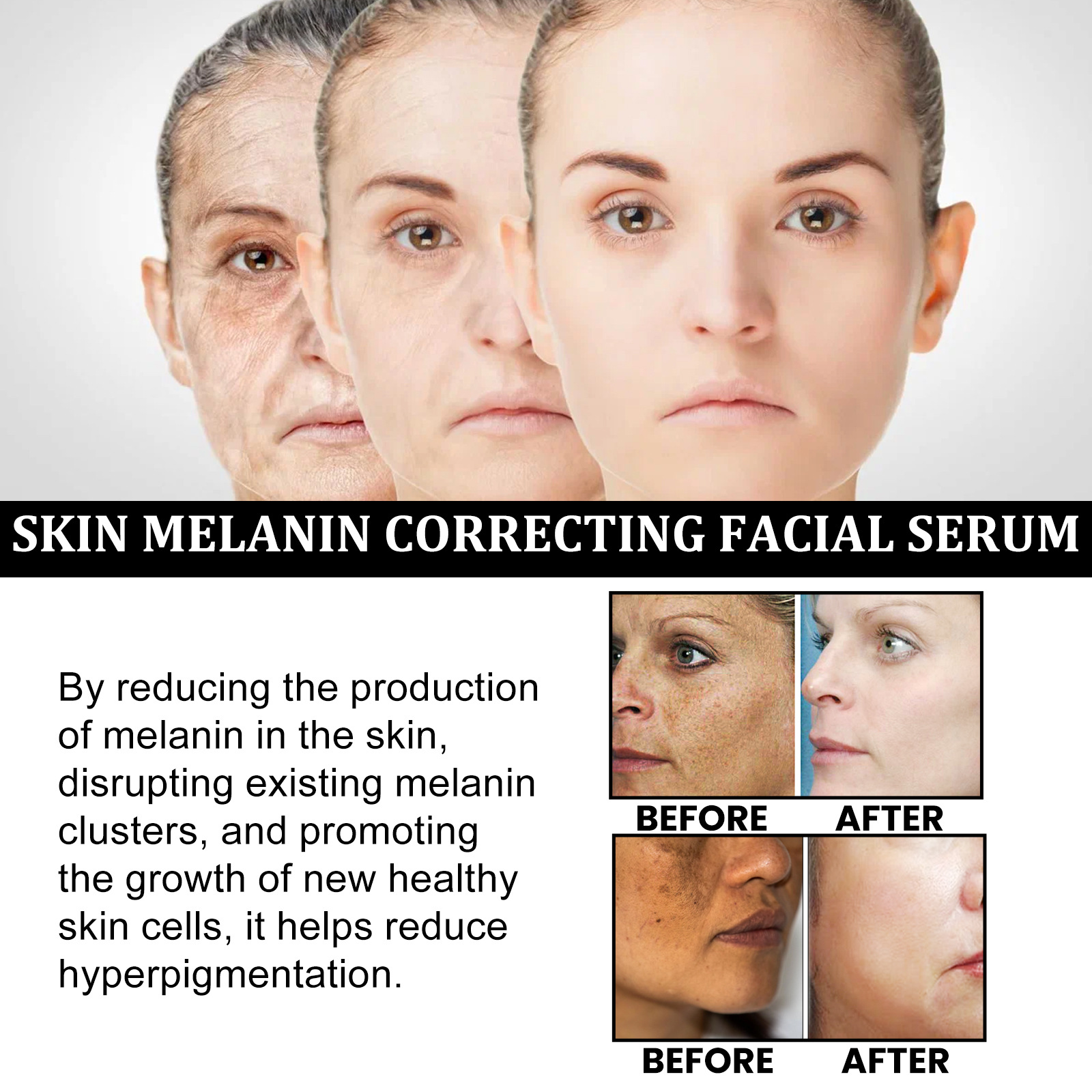 EELHOE Skin Melanin Correcting Serum Fade Dark Spots Anti Freckle Melasma Remover Dull Skin Nourish Lighten Pigment Blemish Glow Vitamin C Face Essence.