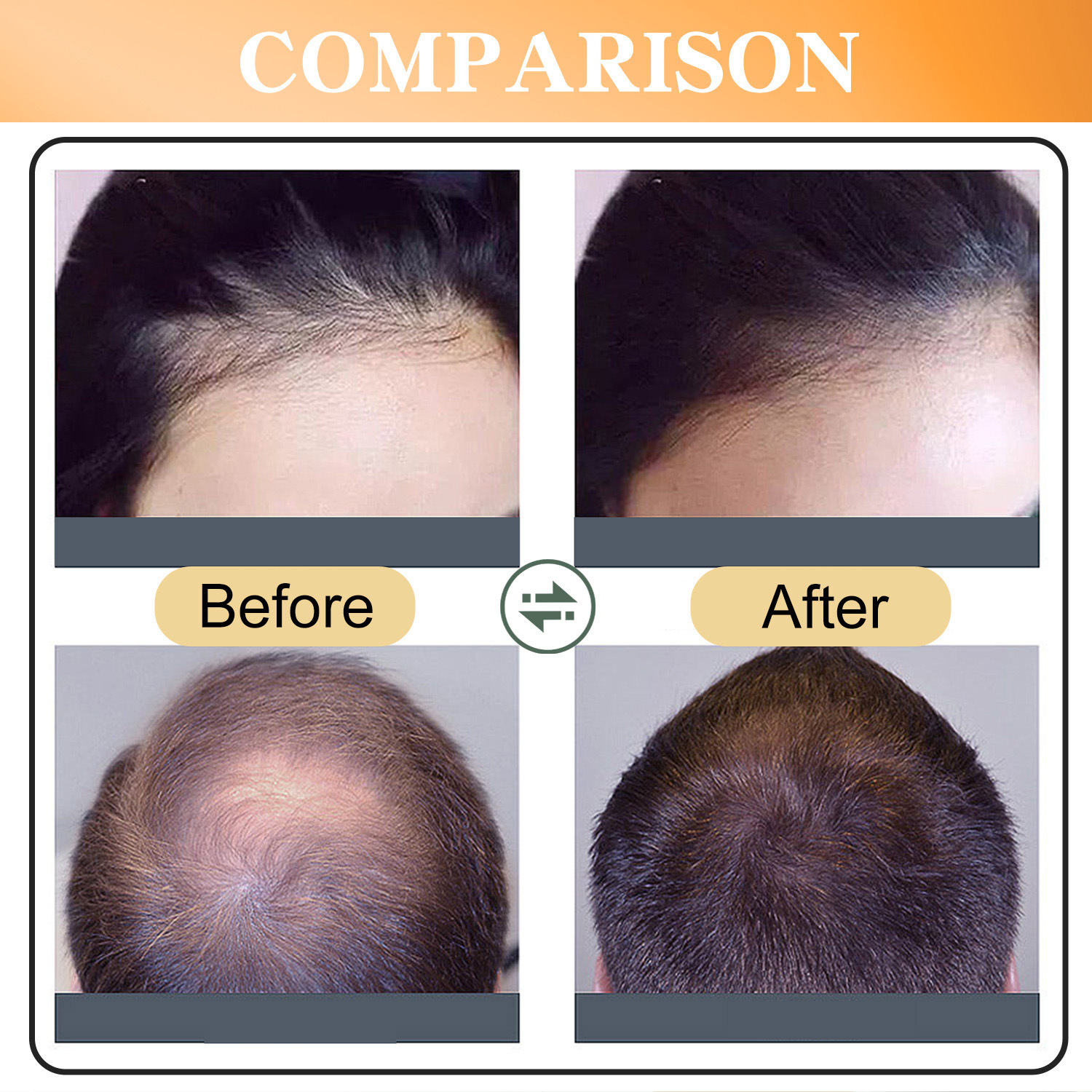 Lanthome Rice Water Hair Spray Nourishing Strengthening Smoothing For Dry Damaged Hair Daily Scalp And Strand Care 50ml