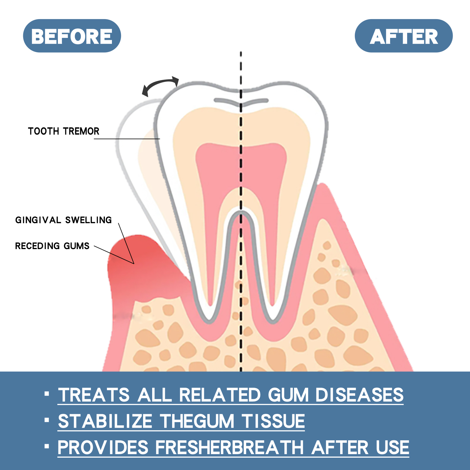 Gum Repair Drops Oral Care Clean Teeth Stains Yellowing Whitening Fresh Breath 30ml