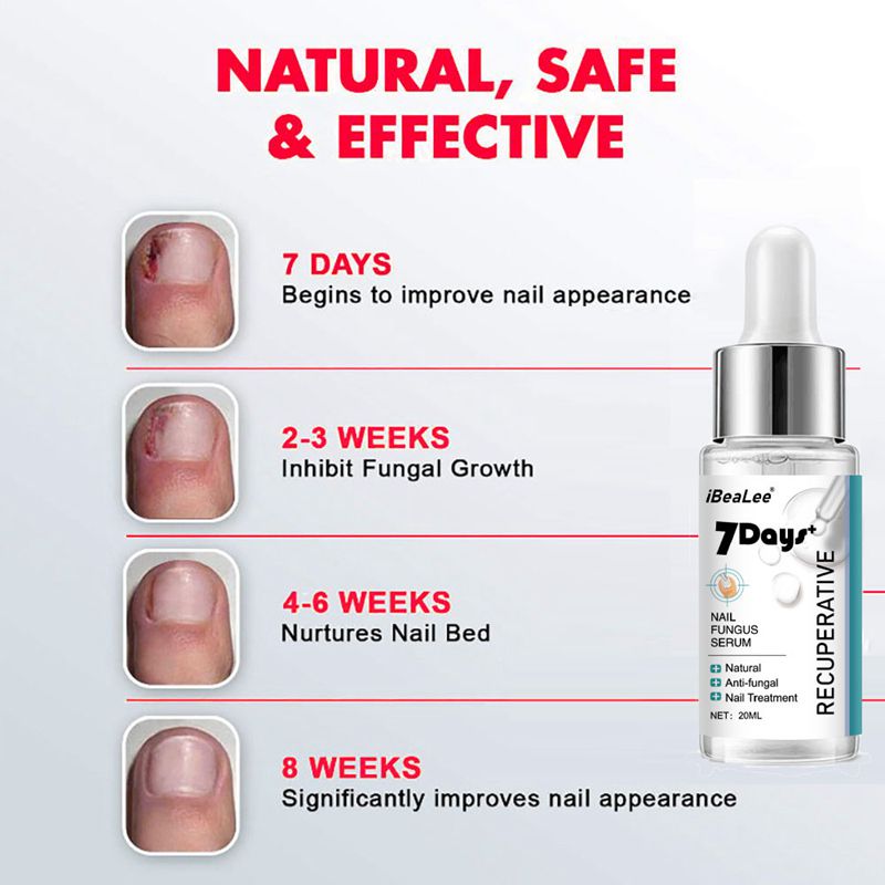 iBeaLee 7 Days Nail Fungus Serum Nail Repair Liquid
