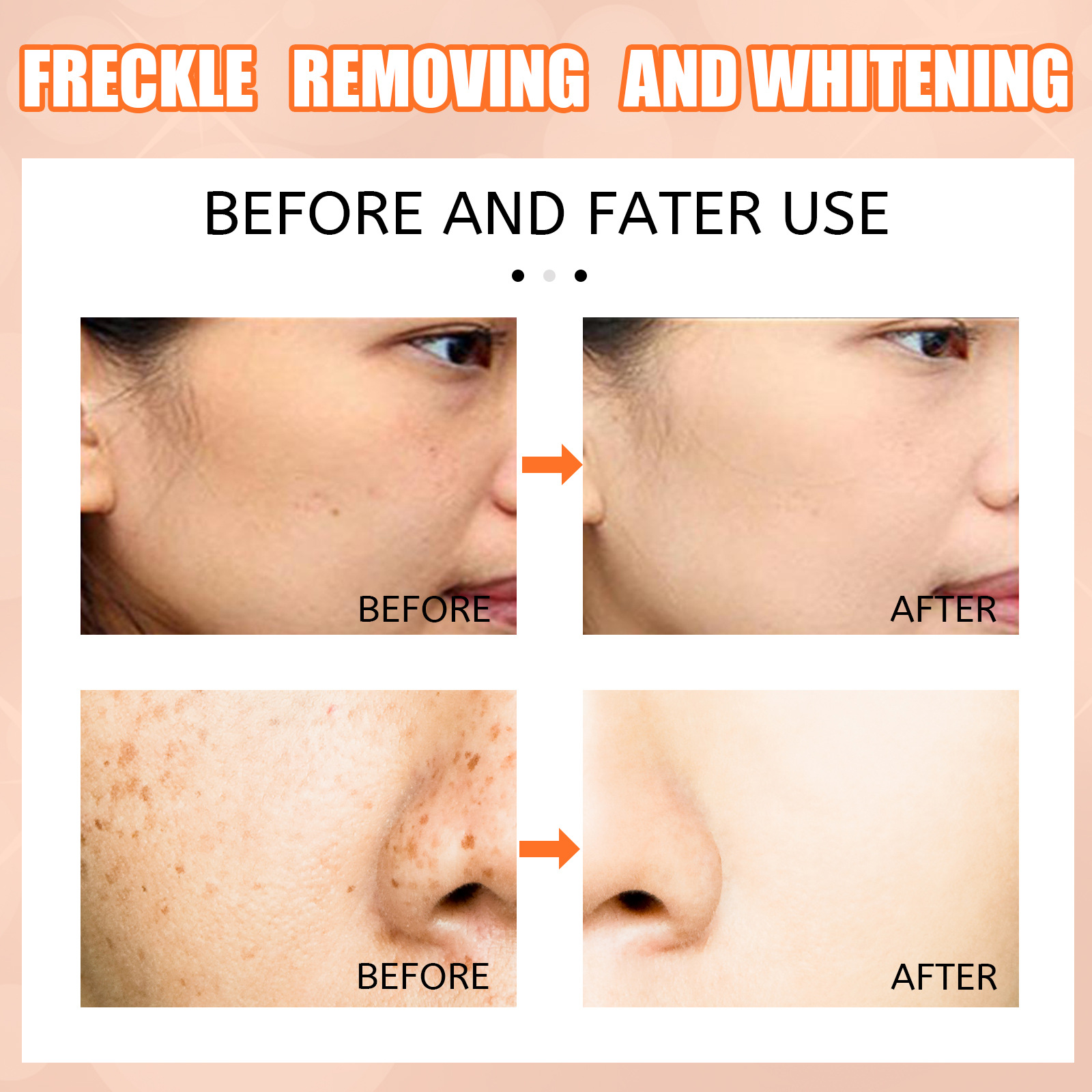 Whitening Freckles Cream Anti Freckle Pen Melanin Spots Cream Vitamin C Blemish Removal  Hydrating