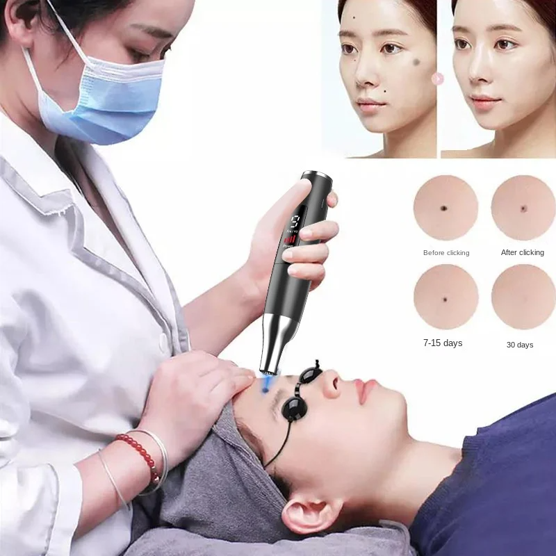 Mole Removal Pen Beauty Salon Special Laser Spot Removal Mole Removal Instrument No Scar Spot Machine Tattoo Eyebrow Washing