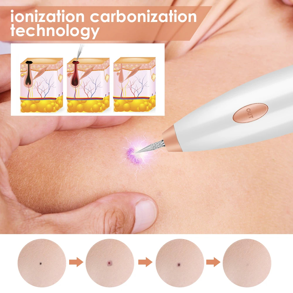 Rechargeable Plasma Pen Skin Tag Remover Mole Removal Tattoo Papilloma Wart Spots Dark Dpot Black Dot Nevus Freckle Flat Blemish Pimples Removal Pen