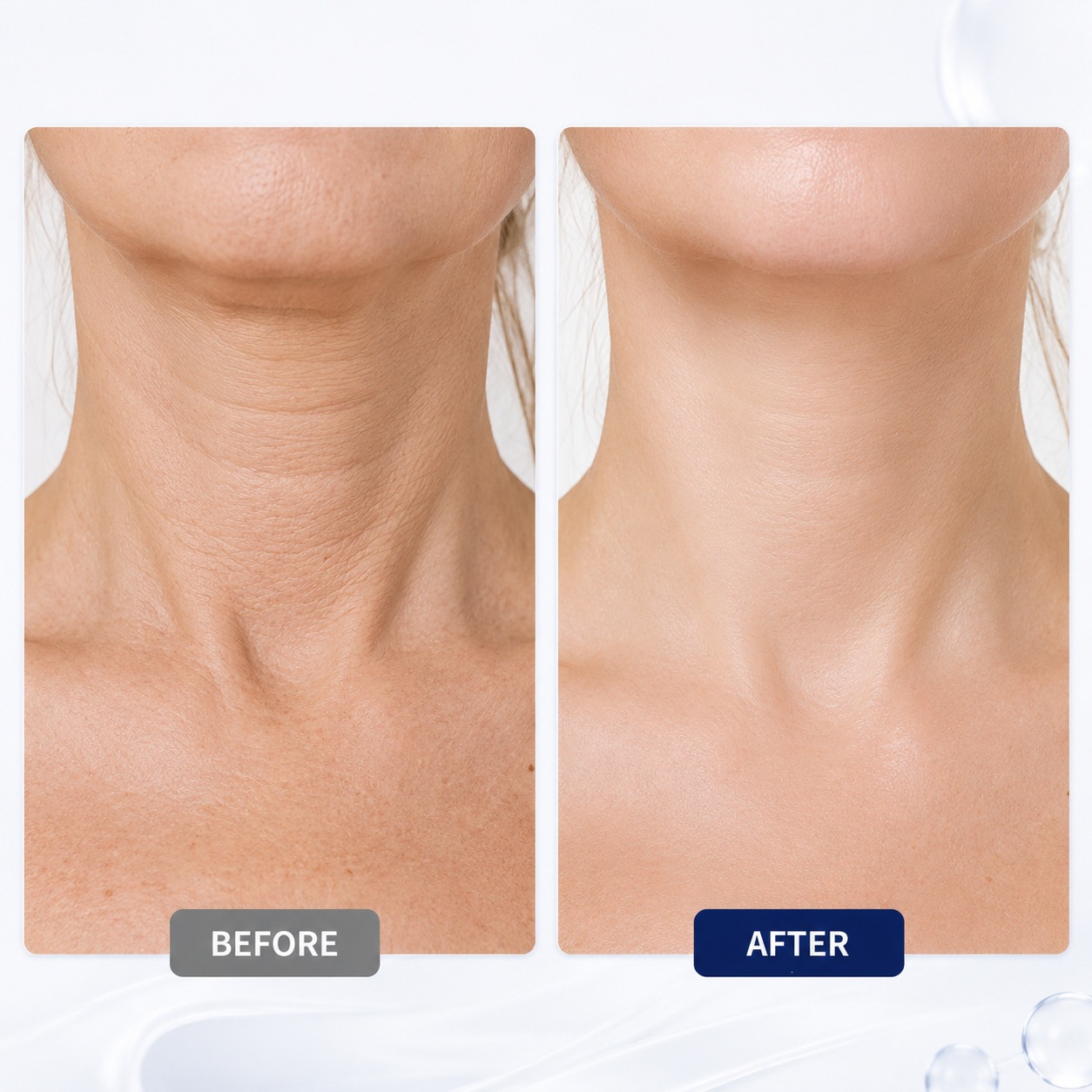 Collagen Fullerene Neck Cream For Firming Smoothing And Nourishing Neck Skin Care 100ml