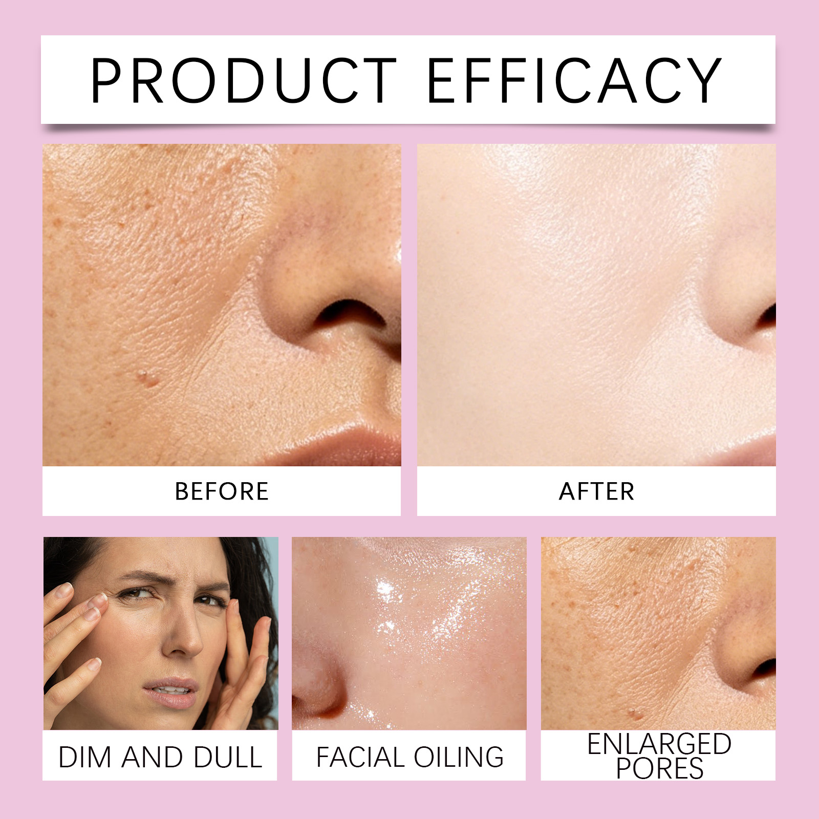 Soft Pore Treatment Serum Gentle Comfort Silky Light Hydrating Tender Smooth Facial Complexion