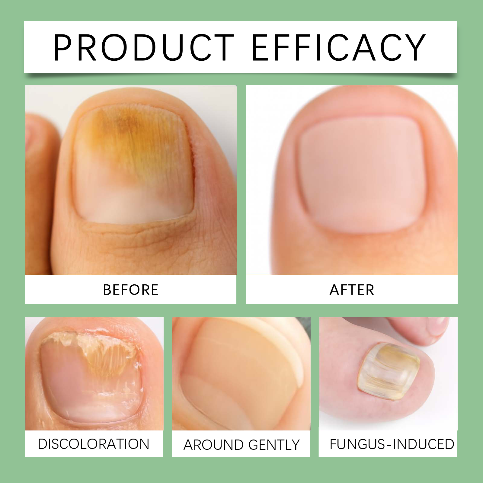 Soft Nail Perimeter Care Liquid Gentle Nail Surface Cleansing Hand Foot Daily Nursing Fingertip Comfort Glossy