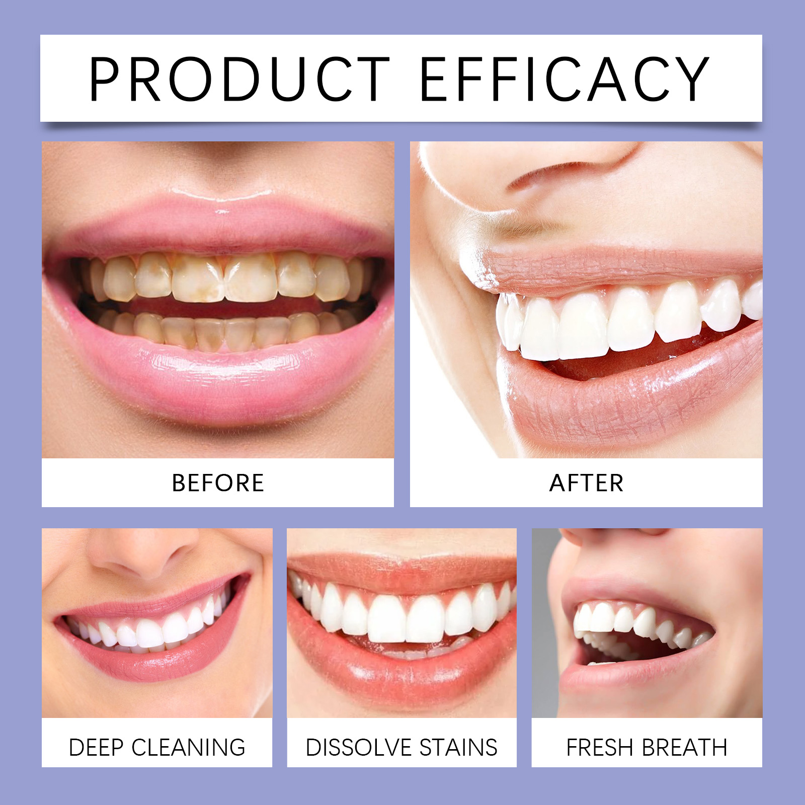 Tooth Brightening Care Toothpaste Gentle Gum Protection Removes Stains Plaque Freshens Breath Teeth