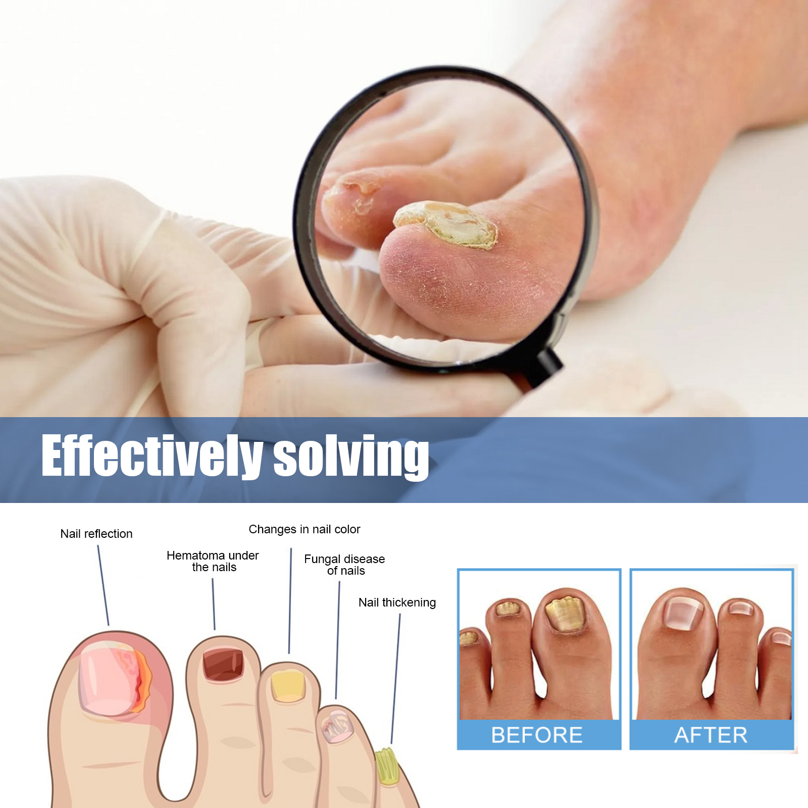 Nail Repair Patch For Soft Ingrown Thickened Nails Overnight Moisturizing Care For Toenails And Fingernails Daily Home Treatment