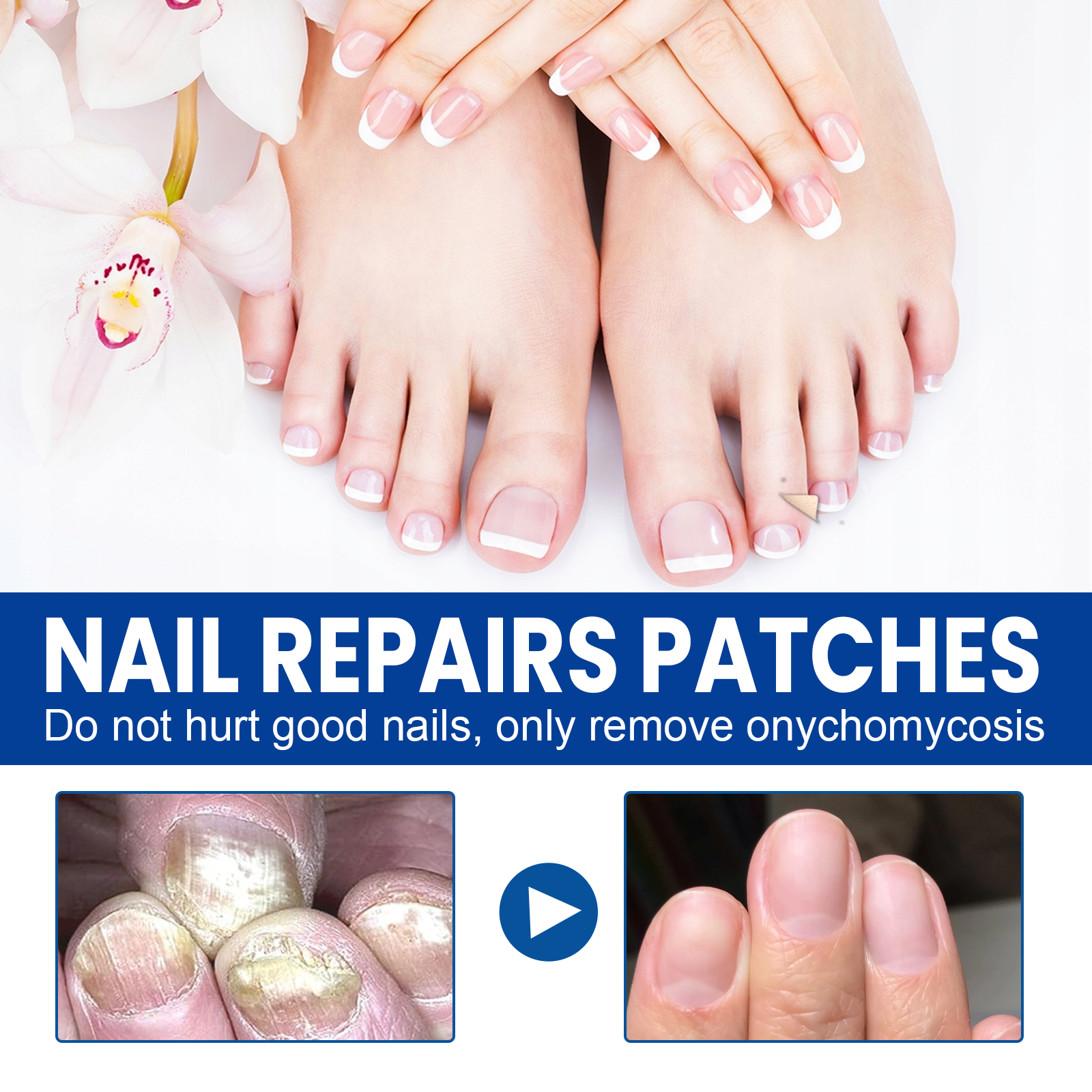 Nail Repair Patch For Soft Ingrown Thickened Nails Overnight Moisturizing Care For Toenails And Fingernails Daily Home Treatment