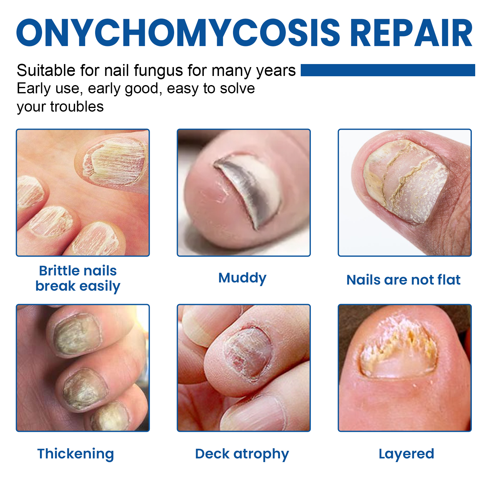 Nail Repair Patch For Soft Ingrown Thickened Nails Overnight Moisturizing Care For Toenails And Fingernails Daily Home Treatment