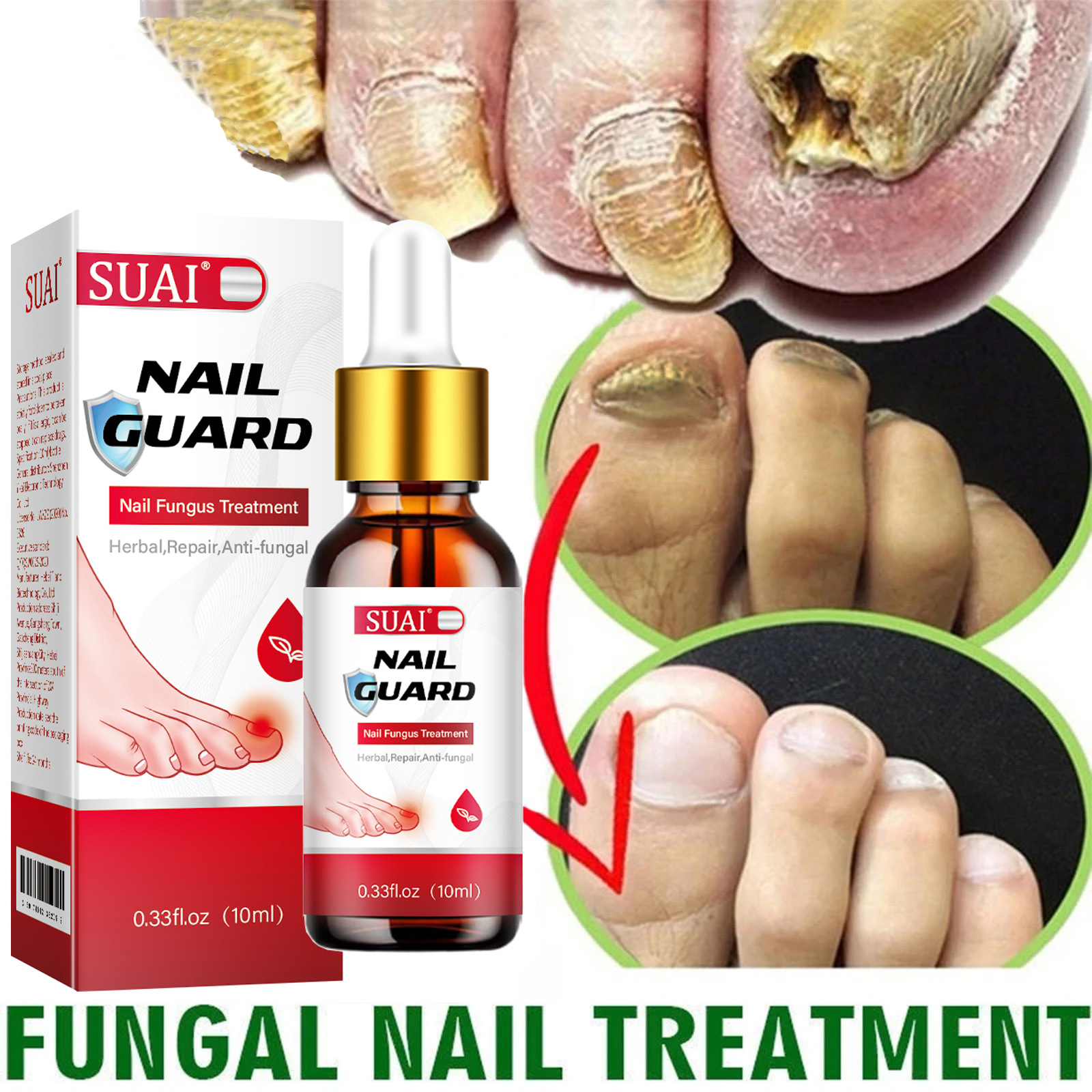 SUAI Nail Cuard Nail Fungal Treatment Herbal Essential Feet Repair Liquid Toe Nail Fungal Removal Anti Infection Paronychia Onychomycosis Tools 10ml
