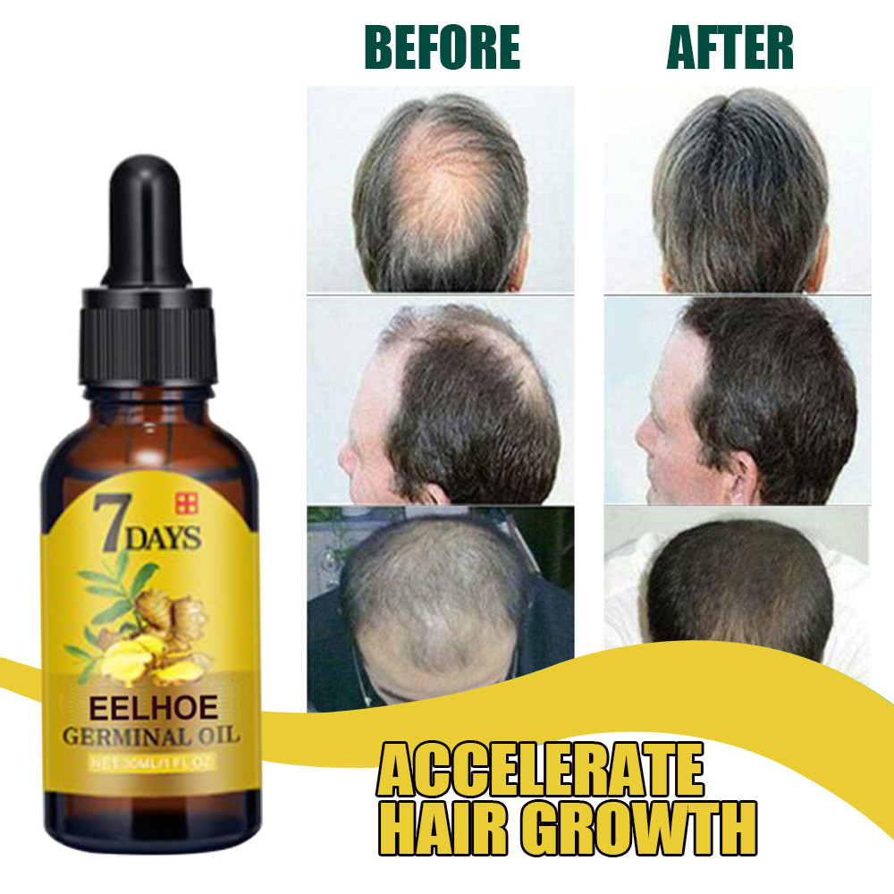 (20ml) Ginger Hair Serum Moisturizing Essence Liquid Essential Oil Hair Loss Scalp Treatments Ginger Ginseng Raise Dense Hair for Damaged Hair