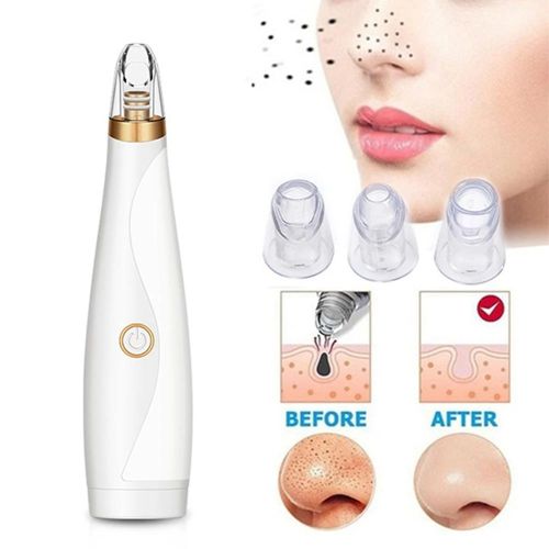 Portable Electric Blackhead Remover Pore Cleansing Device for Facial Beauty