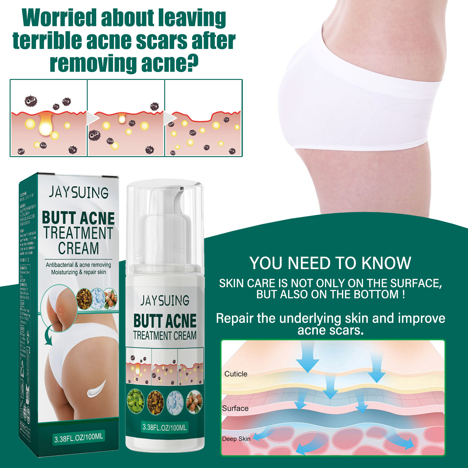 Jaysuing Butt Acne Treatment Cream Clearing Buttock Thigh Acne Bumps Dark Spots Moisturizing Smoothing Hydrating Body Care