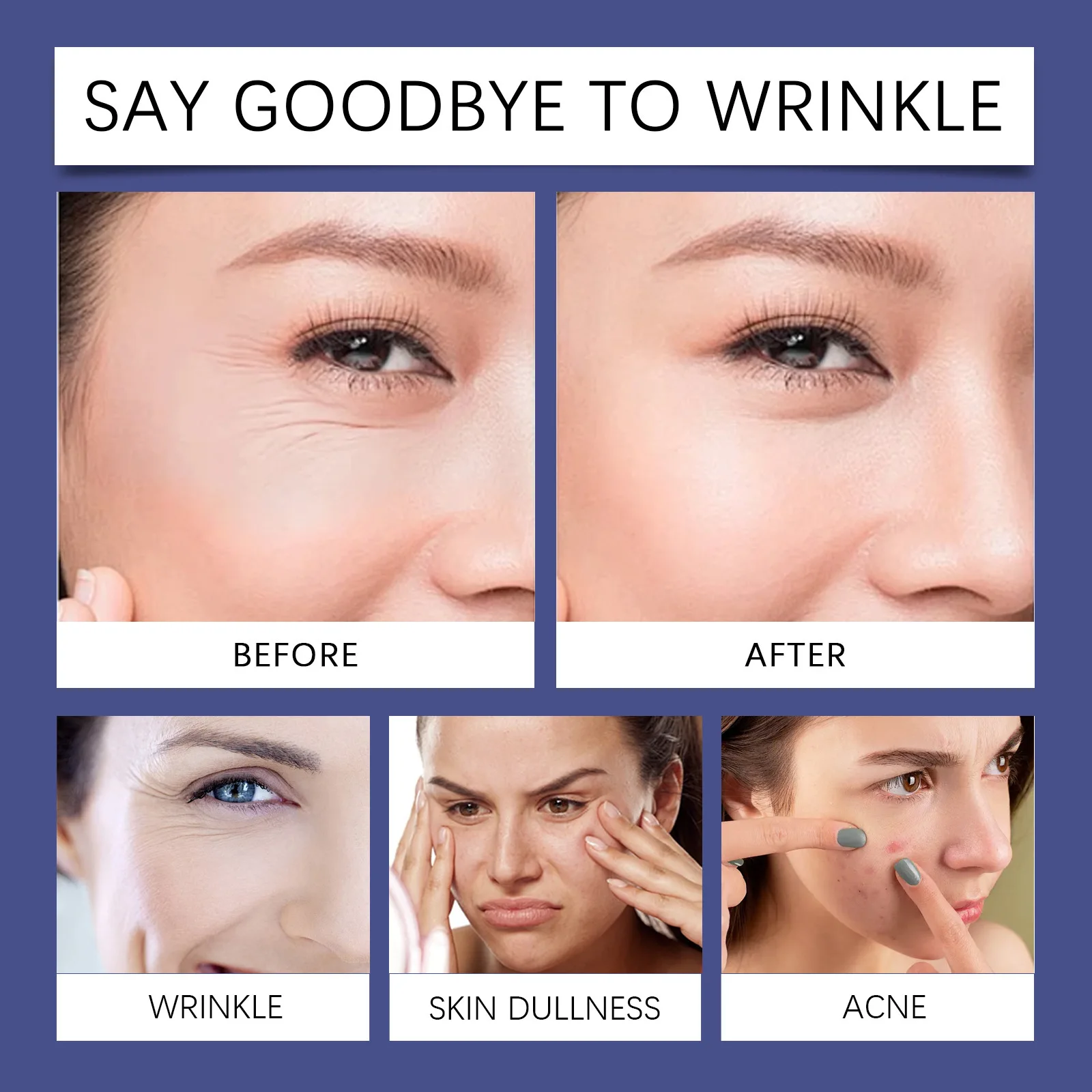 Hoygi Retinol Facial Moisturizer Face Cream Hyaluronic Acid Collagen Retinol Essence Hydrating Anti Wrinkle Anti Aging Night Creams Skin Care Cream 50g