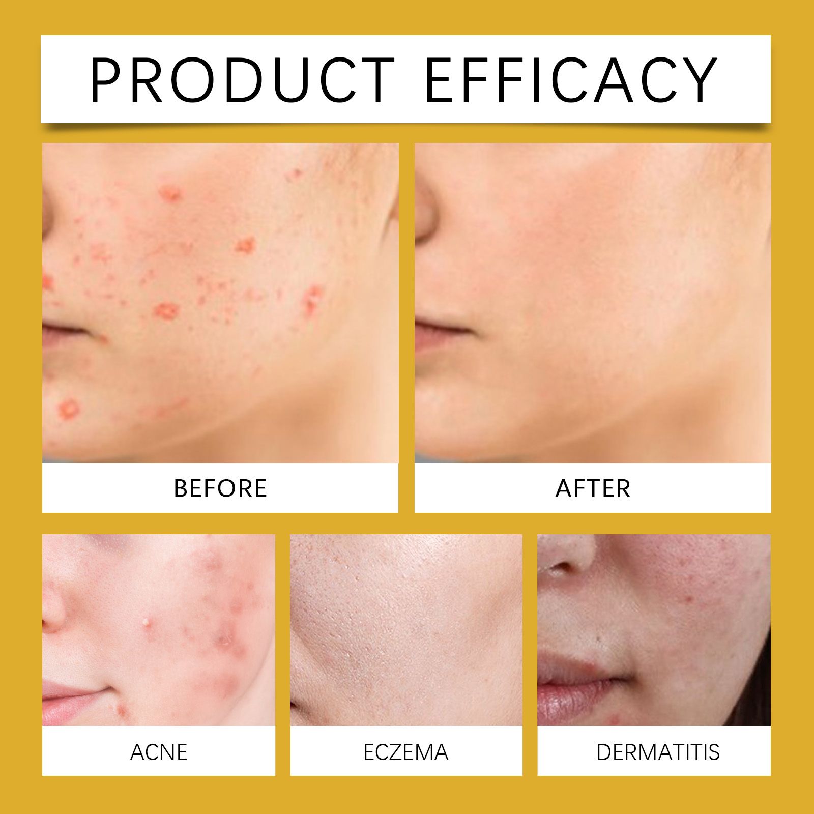 Skin Essence Ampoule Mild Formula Reduce Flat Warts Facial Eye Smooth Care Daily Nursing