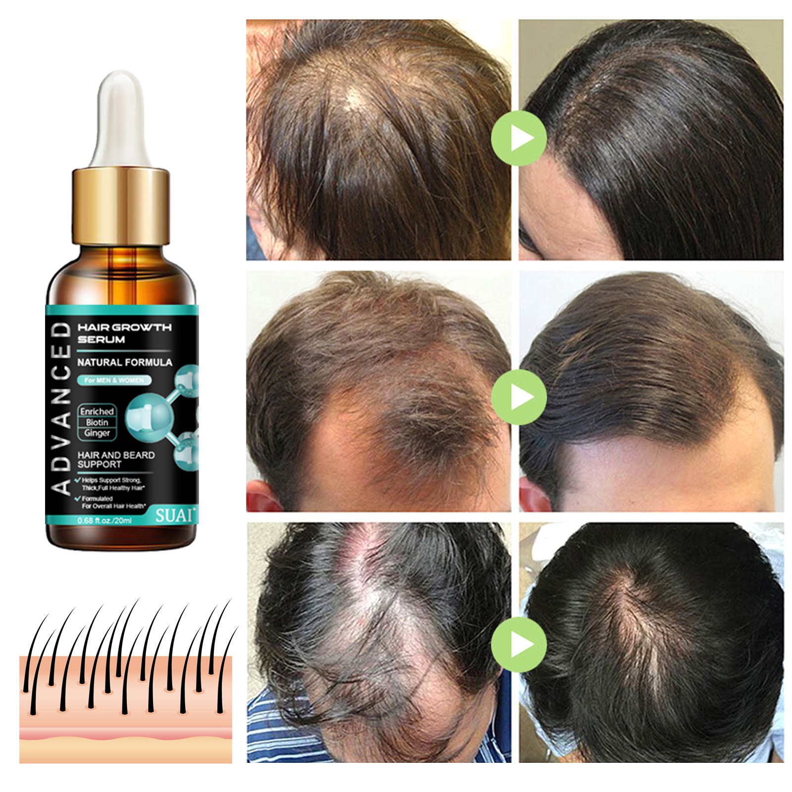 Hair Growth Serum Hair Essence Hair Nourishing Solution Liquid Treatment Anti Hair Loss Hair Care Dense