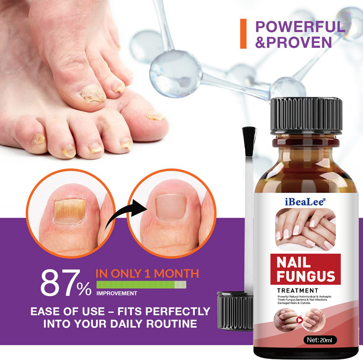 iBeaLee Nail Fungus Treatment Onychomycosis Repair Liquid Anti-Infective Oil Essence Serum Hand And Foot Care Supplies for Men Women 20ml