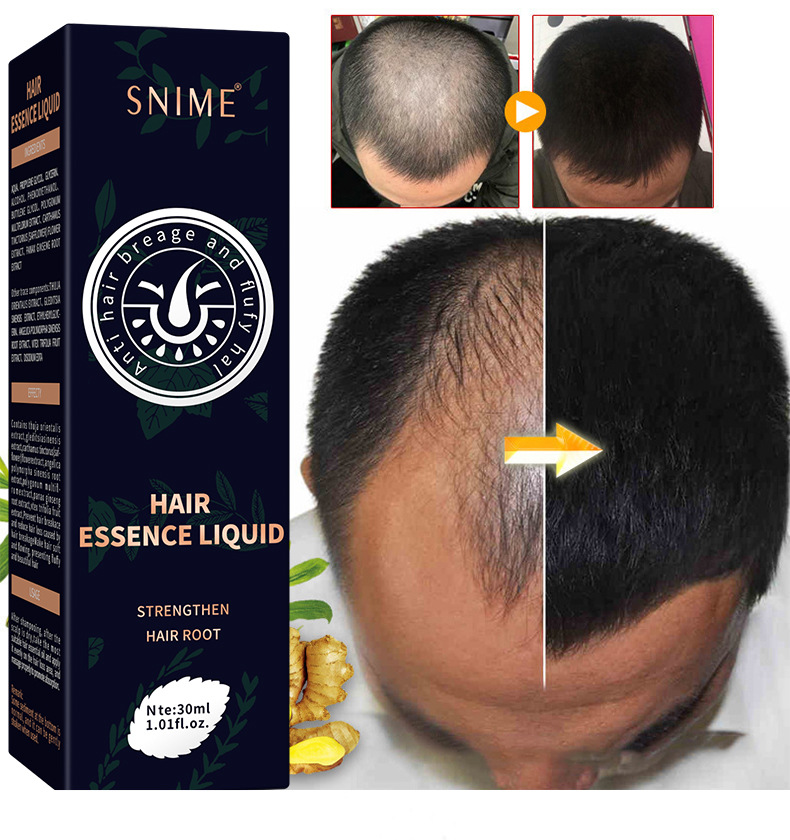 Snime Hair Essence Liquid Hair Serum Provide Nutrition Repair Spray 30ml