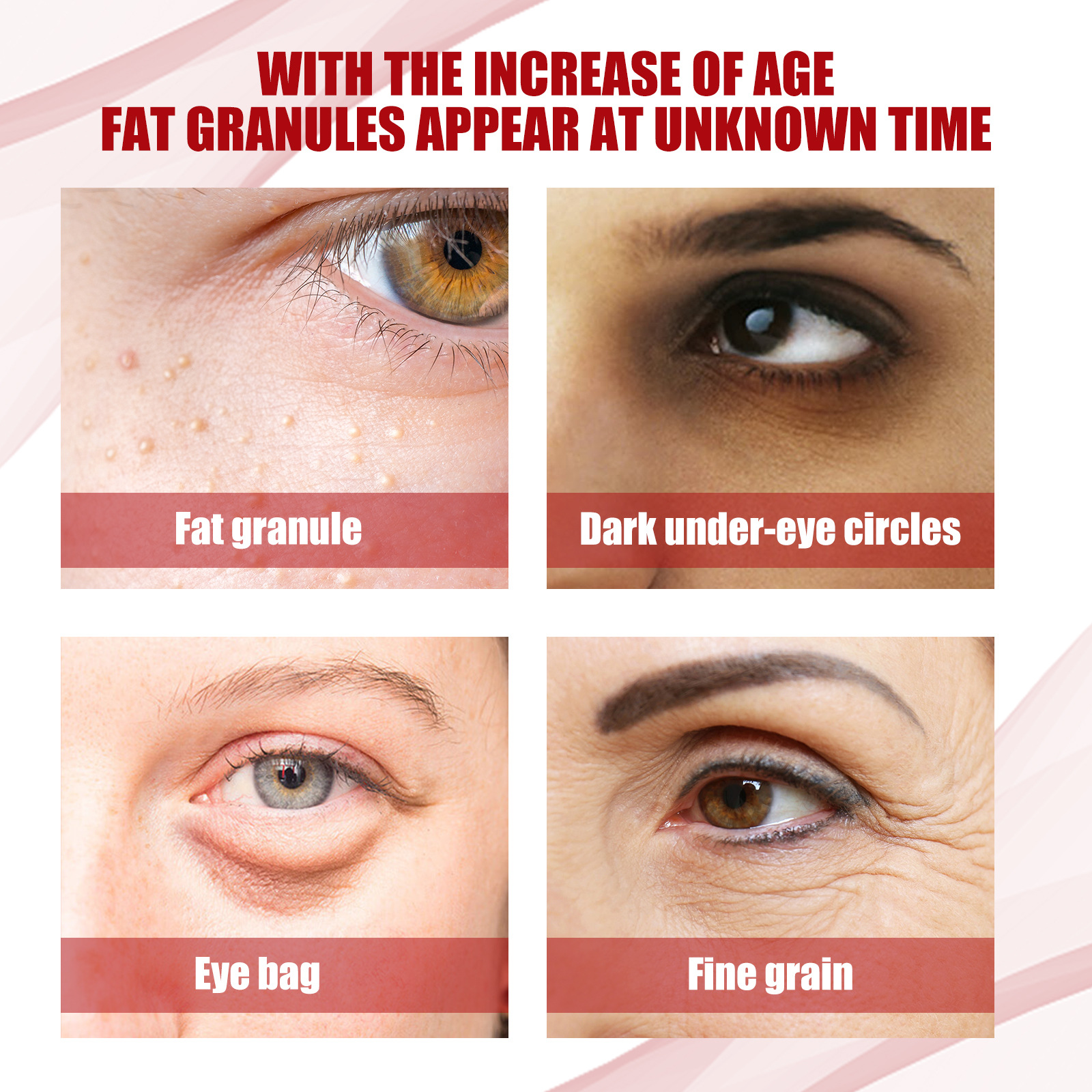 Anti-fat Granule Essence Remove Particles Around the Eyes Fade Fine Lines Firming and Lifting Eye Serum Beauty Care