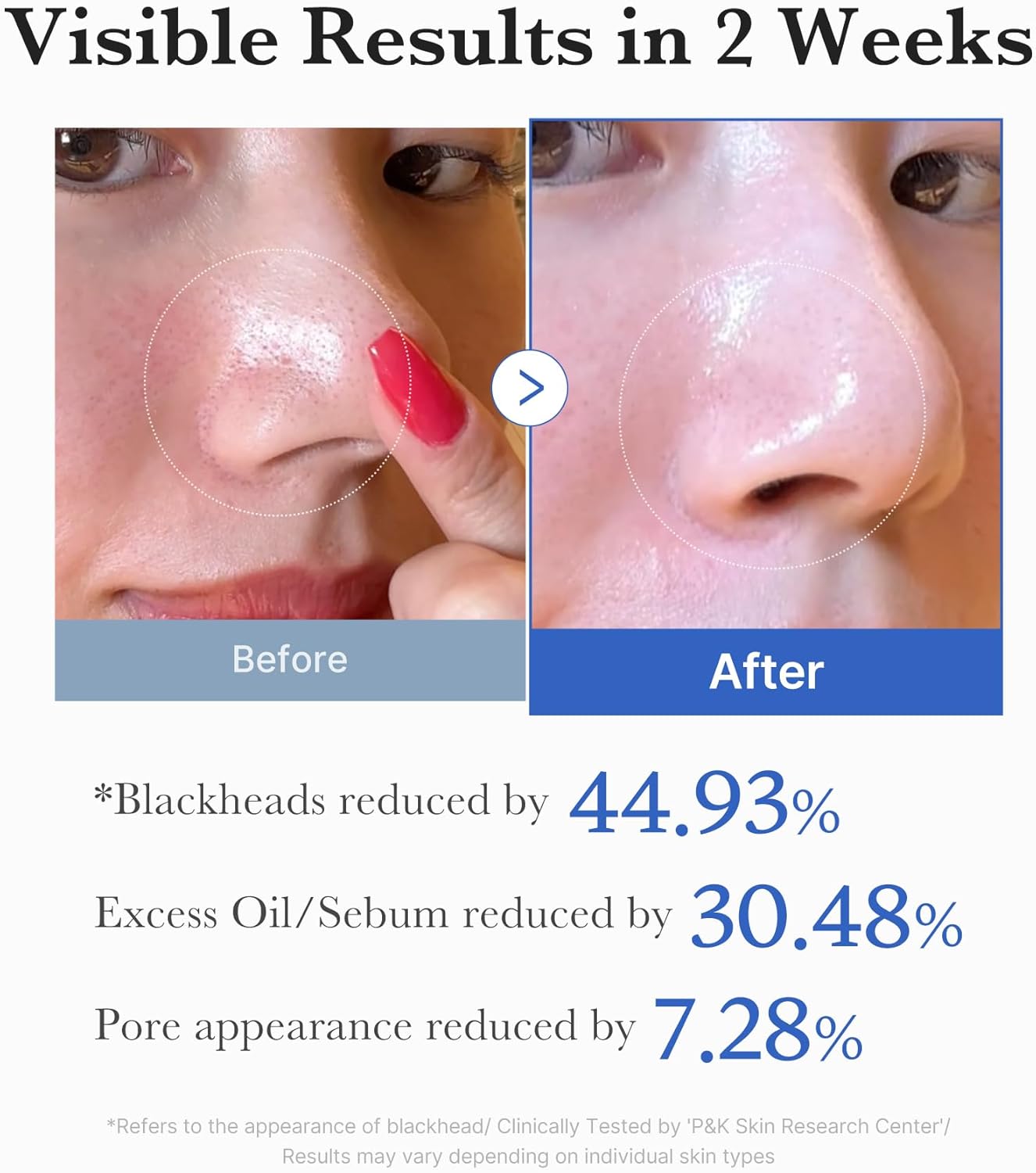 medicube Zero Pore Pads Dual-Textured Facial Toner Pads Exfoliation and Pore Care with AHA Lactic Acid BHA Salicylic Acid All Skin Types Korean Skin Care 155g