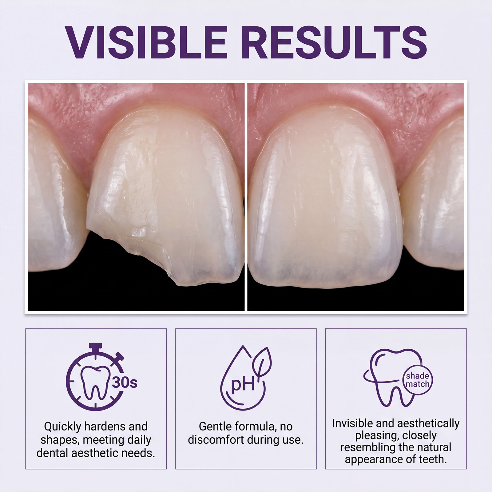 Gentle Formula Dental Care Kit For Daily Teeth Surface Beautifying Boost Smile Charm Appearance Display Attractive Look