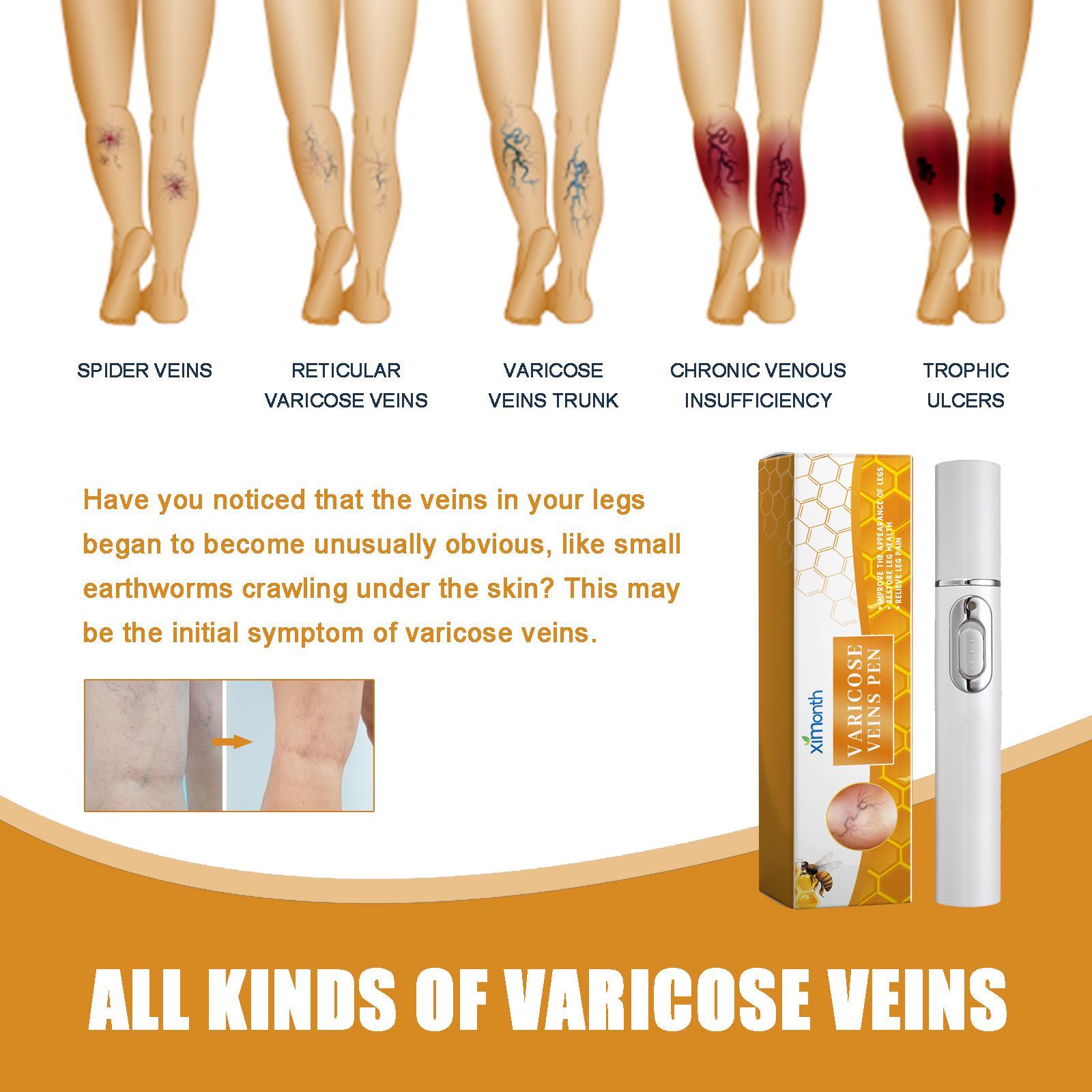 Leg Repair Pen LED Light Therapy For Soothing Discomfort And Leg Massage Daily Body Care 1 PCS