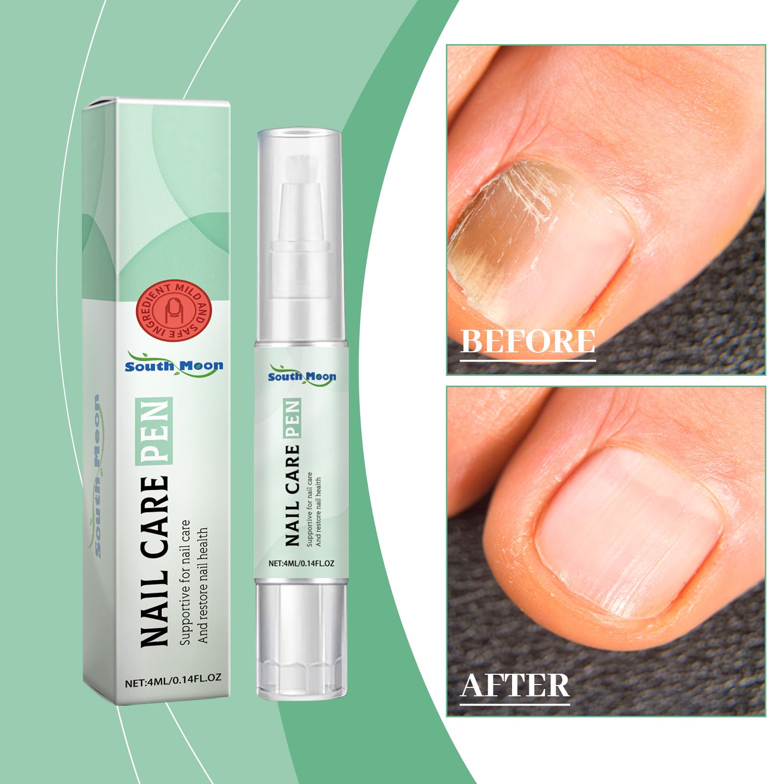 Nail Care Pen For Toenails And Fingernails Gentle Moisturizing Strengthening Daily Home Treatment