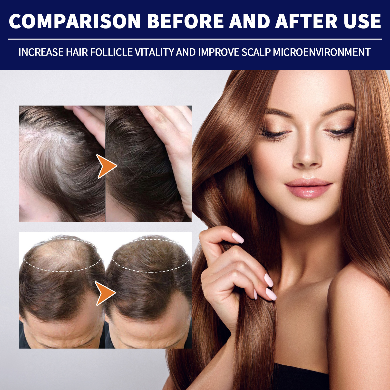 Hair Growth Serum Hair Growth Oil Anti-Hair Loss Nourishing Hair Roots Reapir Scalp Care Products Anti Thinning Hair Treatment Hair Regrowth Treatment