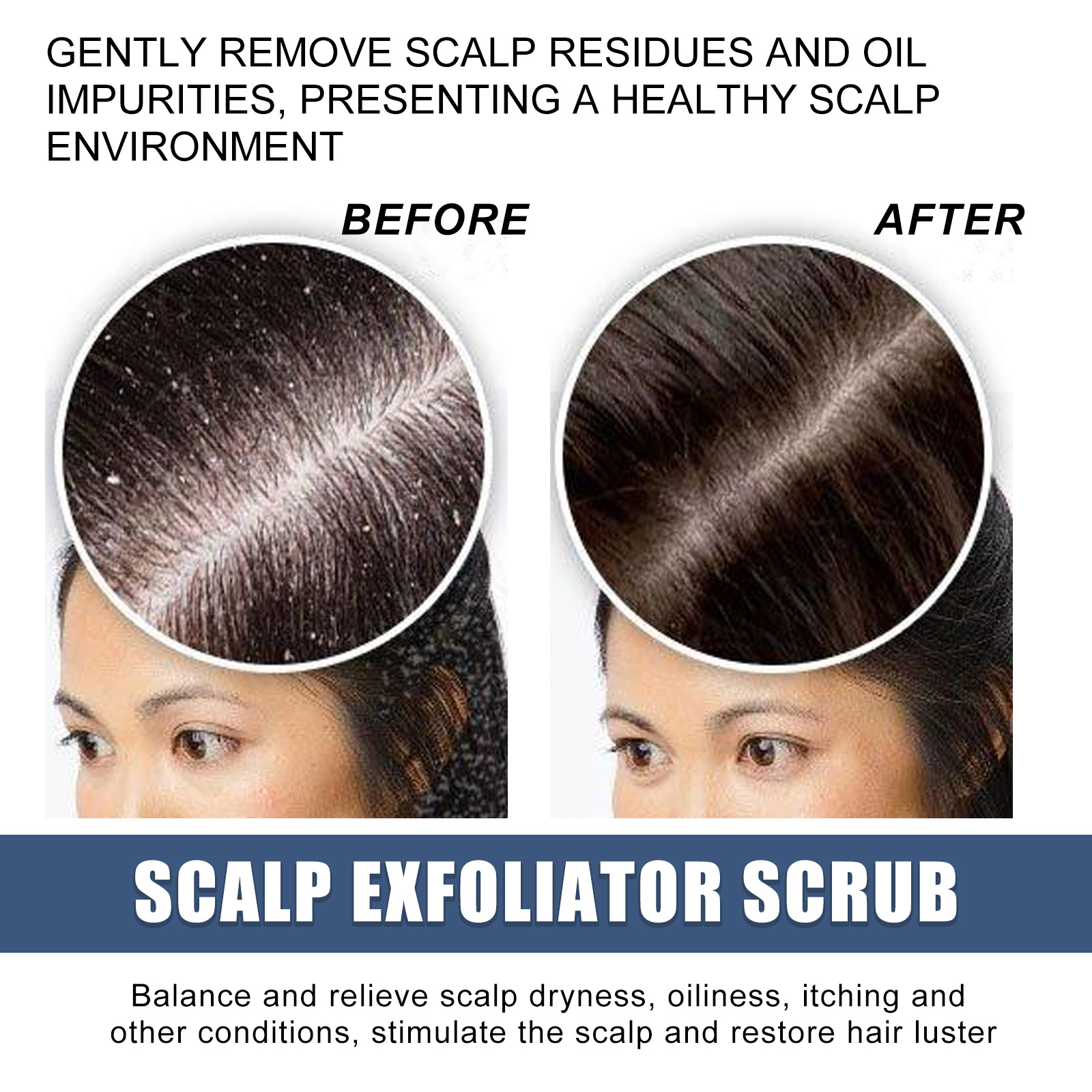 Scalp Exfoliating Scrubs Hair Scratcher Scalp Oil Nutritional Effectively Repairs Damaged Dry Hair Restore Smoothness Promote Scalp Cleanse Treatment