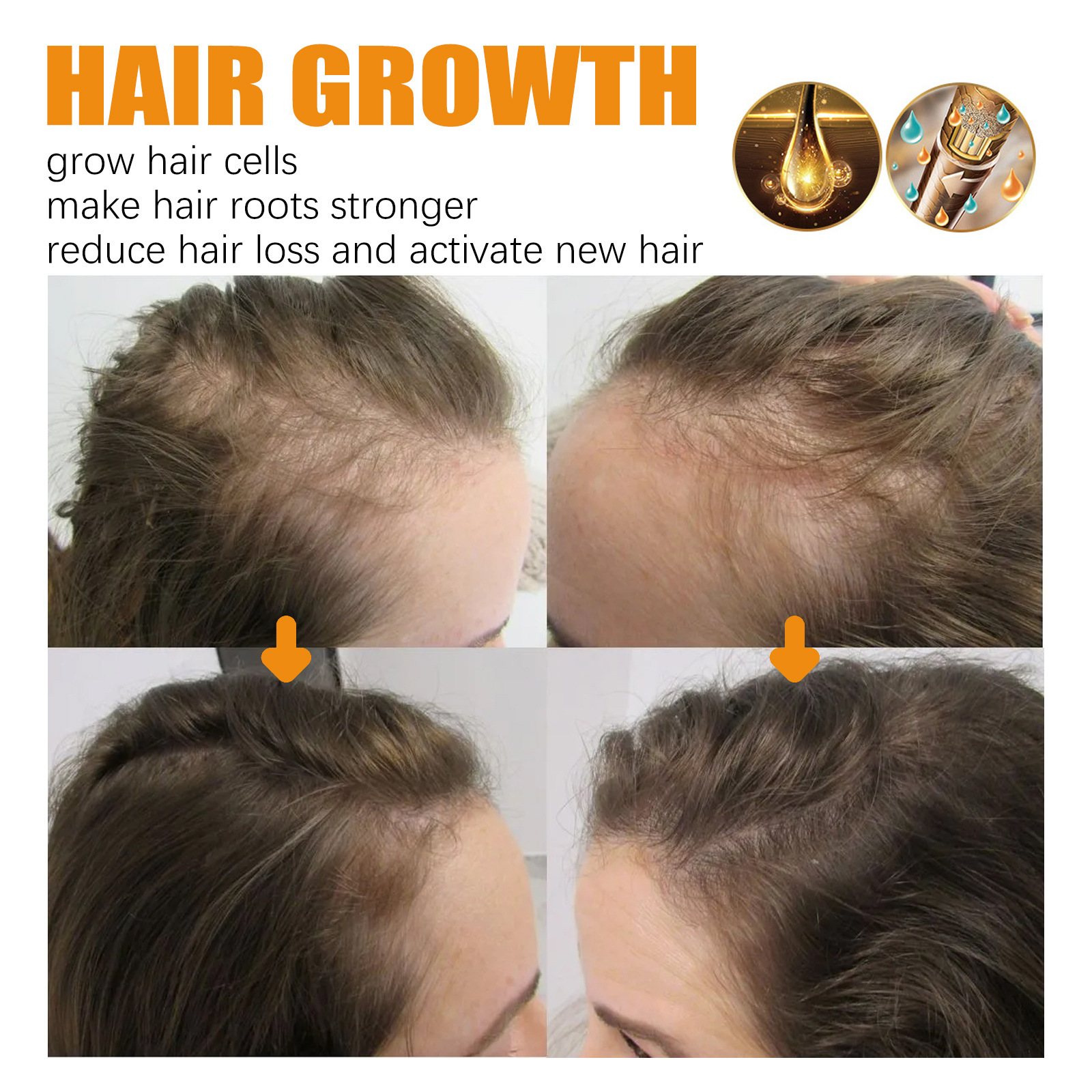 (Hair Essential Oil) EELHOE Biotin Hair Spray For Man Women Repair Damage Restore Oil Scalp Repair Serum Spray Thicken Hair Health Care Anti Hair Loss Hair Growth Treatment