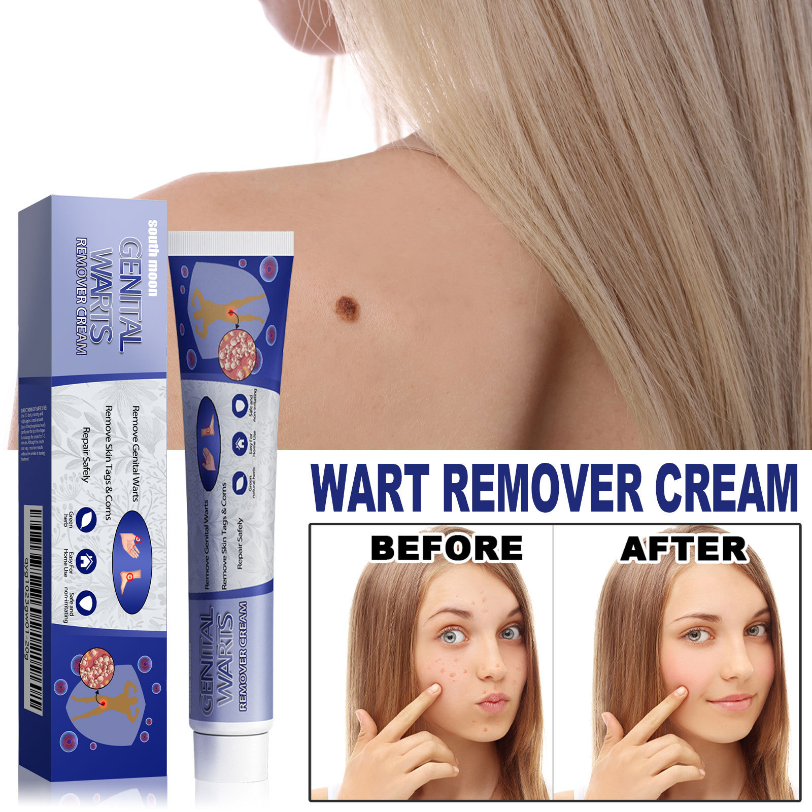 South Moon Skin Tag Remover Liquid Kit Wart and Tag Remover Wart Remover Fast Acting and Painless  for Body Anti Acne Face Cream Natural Safe Mole Remover