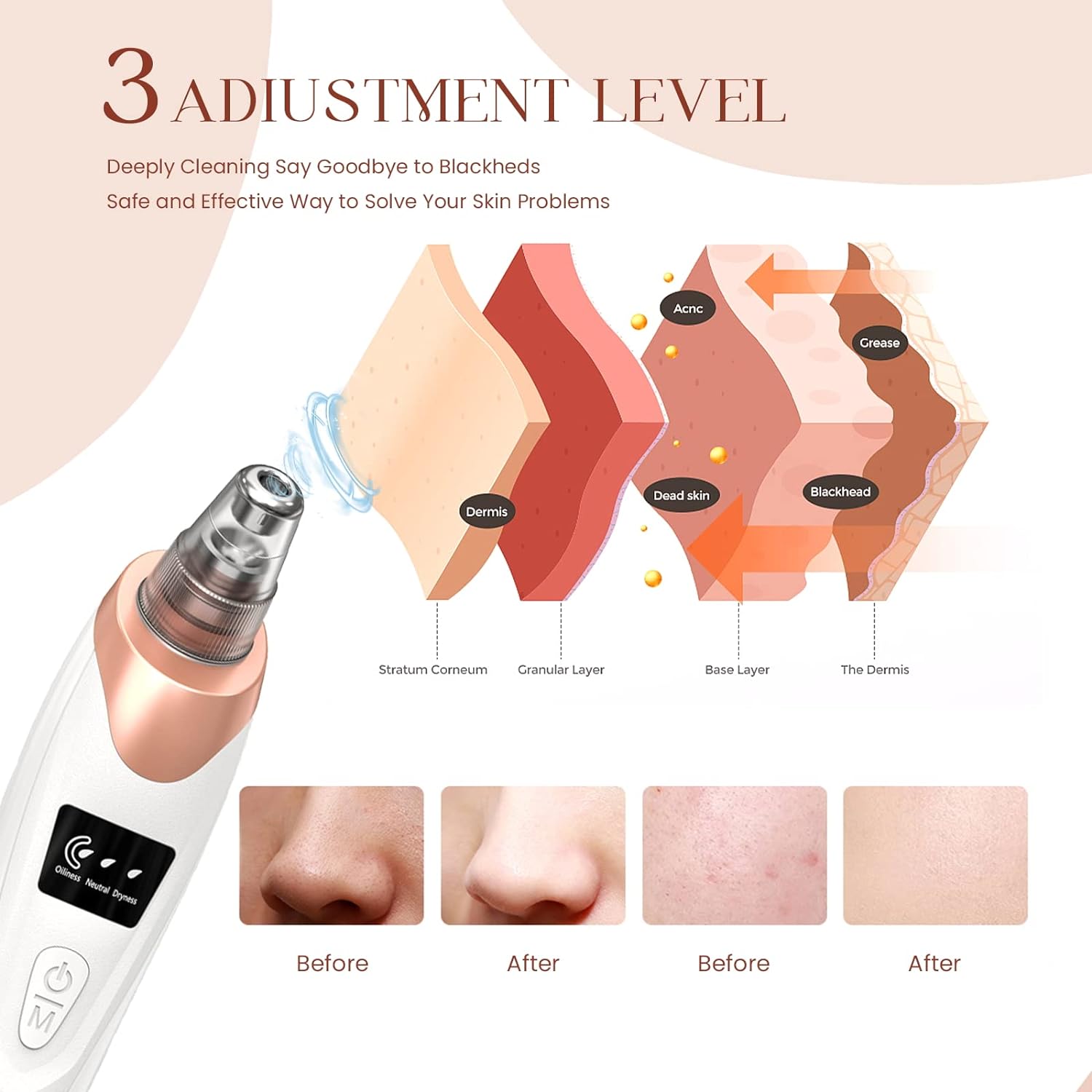 Blackhead Remover Vacuum Pore Cleaner for Face Nose Mite Blackhead Removal Instrument Kit Electric Acne Facial Extractor Tool Newest Technology