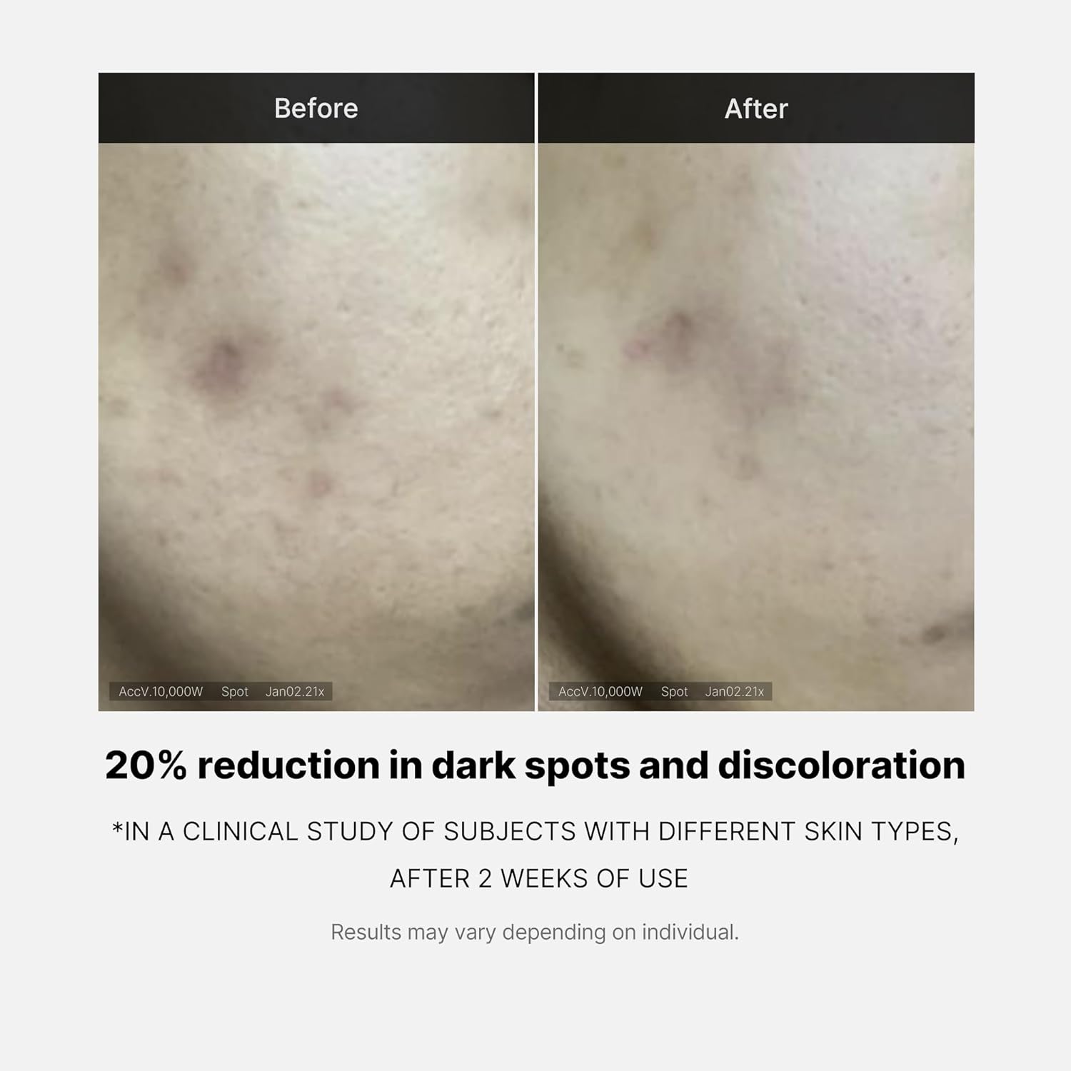 Medicube Deep Vita C Serum Pure Vitamin C reduce the appearance of hyperpigmentation dark spots and blemishes Korean skincare 10g  3 bottles