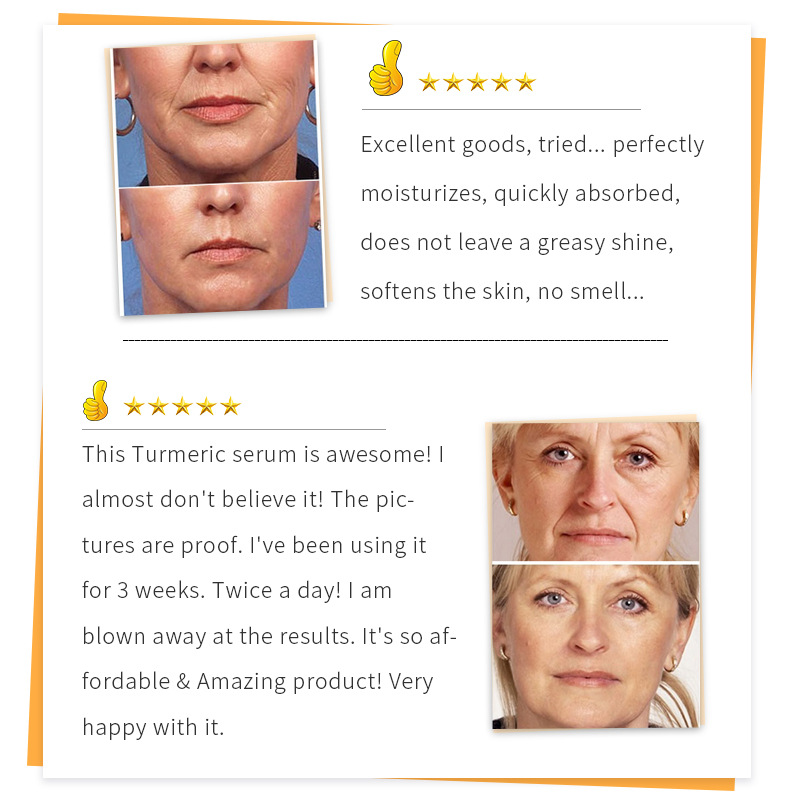 Turmeric Facial Serum For Brightening Nourishing And Evening Skin Tone Daily Radiance Boosting Essence 30ml