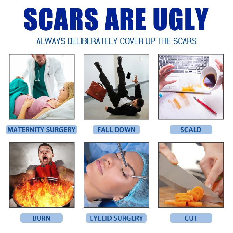 Scar Care Balm For Smoothing Moisturizing And Soothing Skin Daily Comfort Treatment For Burns Cuts And Surgical Scars