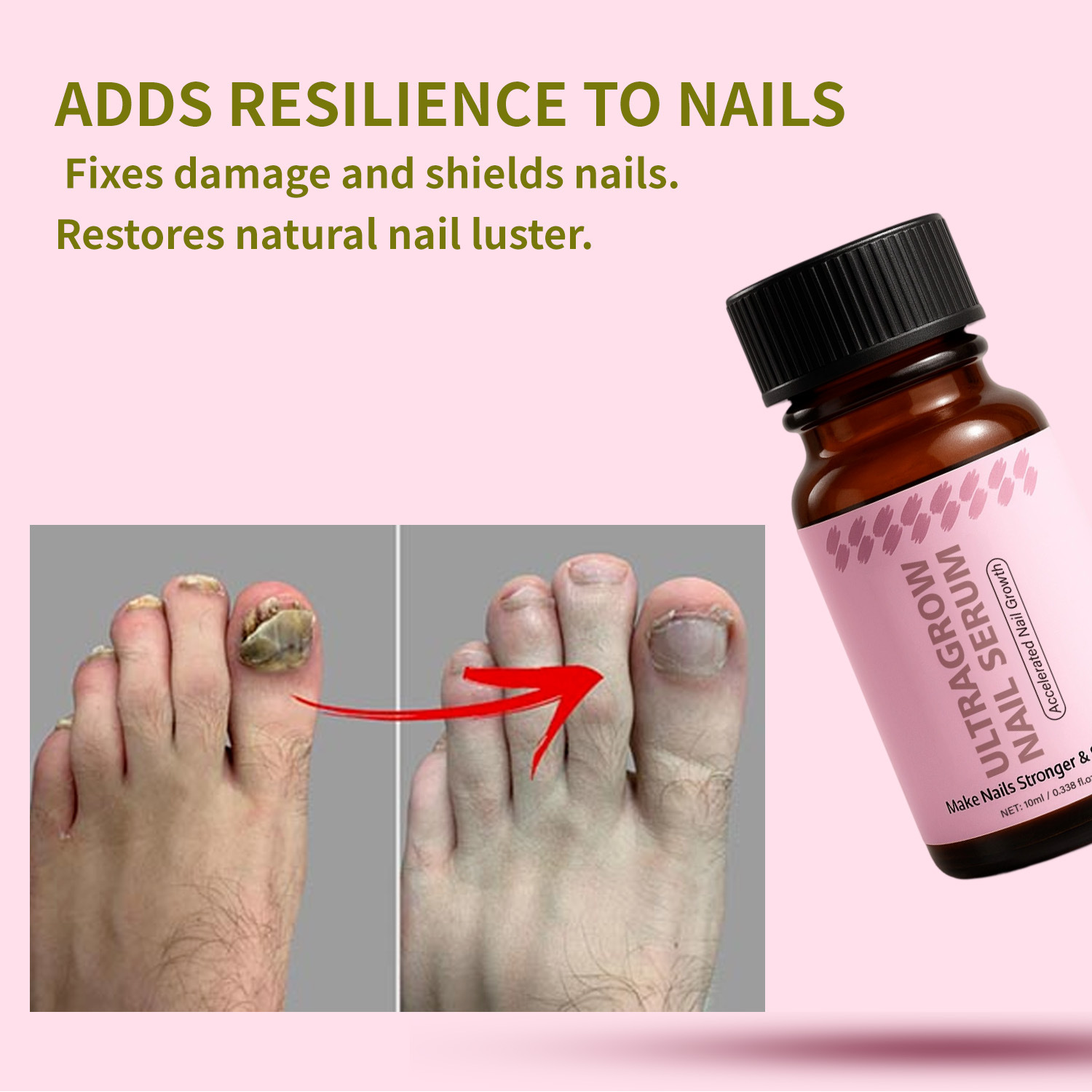 Nail Growth Essence Strengthening Nourishing Repairing For Soft Brittle Nails Daily Home Manicure Treatment 10ml