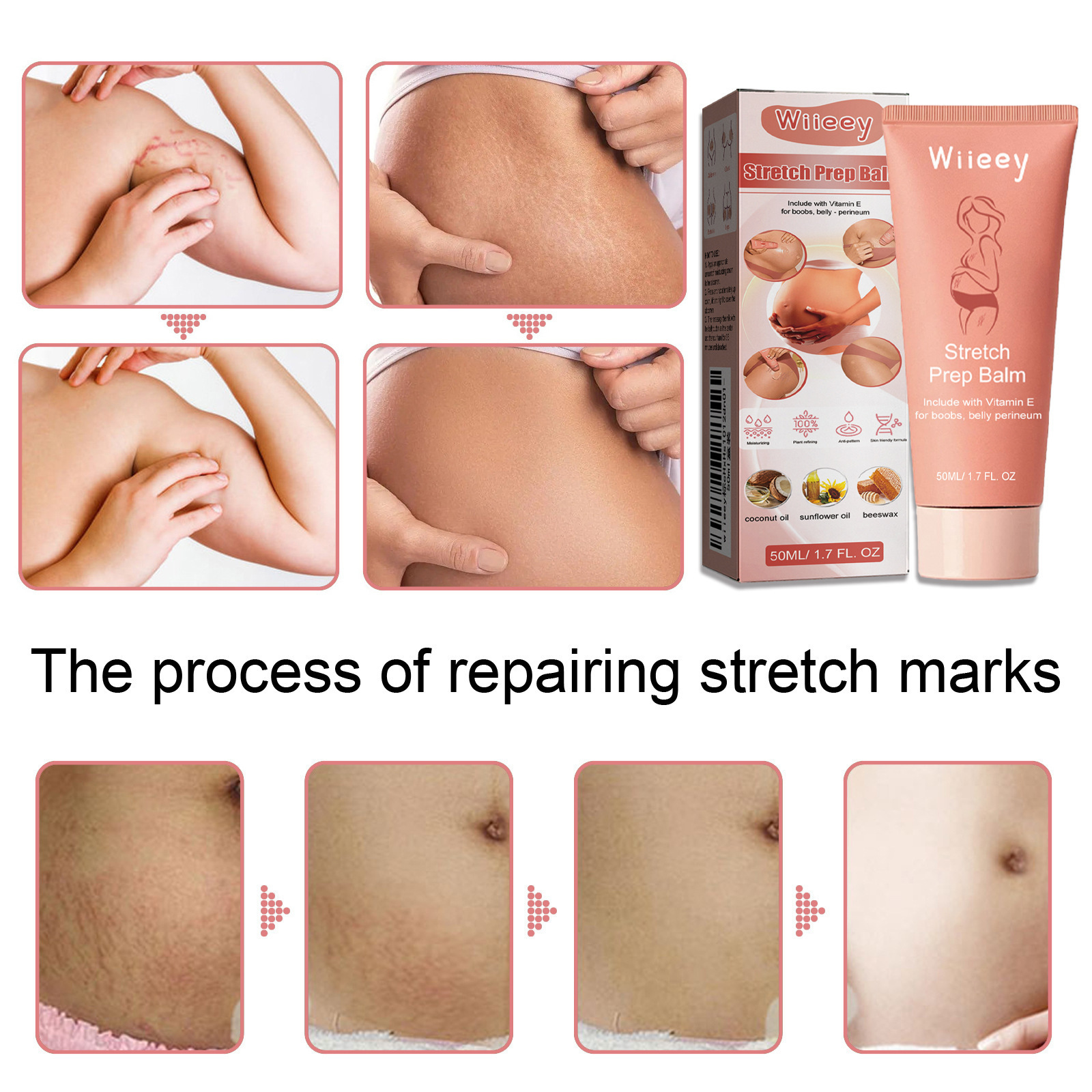 Skin Care Cream For Post Pregnancy Belly Firming Smoothing And Massage Moisturizing Daily Body Recovery Care