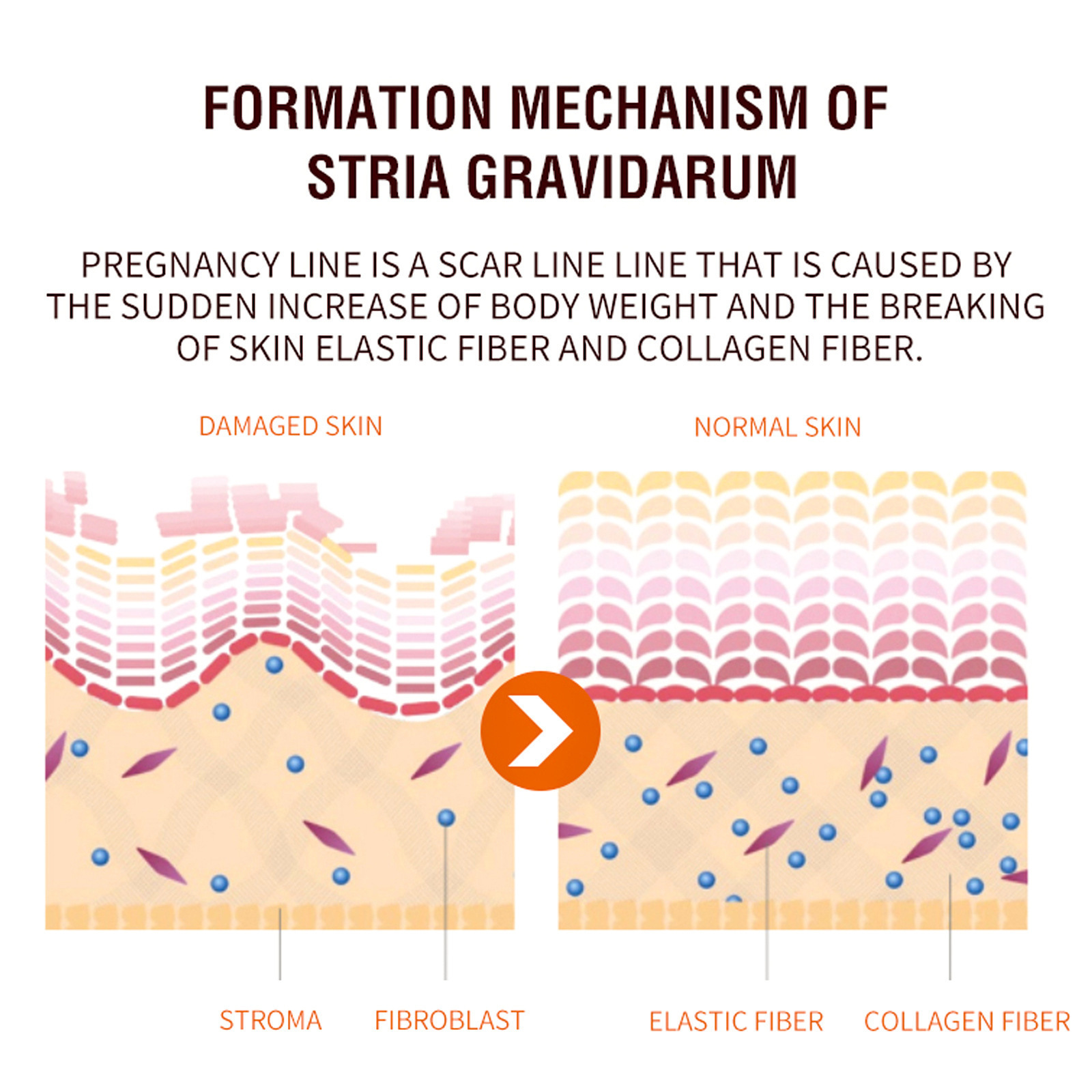 Skin Care Cream For Post Pregnancy Belly Firming Smoothing And Massage Moisturizing Daily Body Recovery Care
