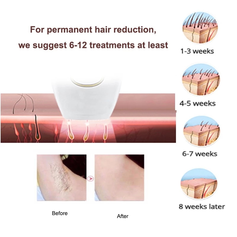 (WHITE) Multi-Function Dropshipping Home Use Beauty Intense Pulsed Light Portable Ipl Hair Removal Handest Professional Ipl Hair Removal