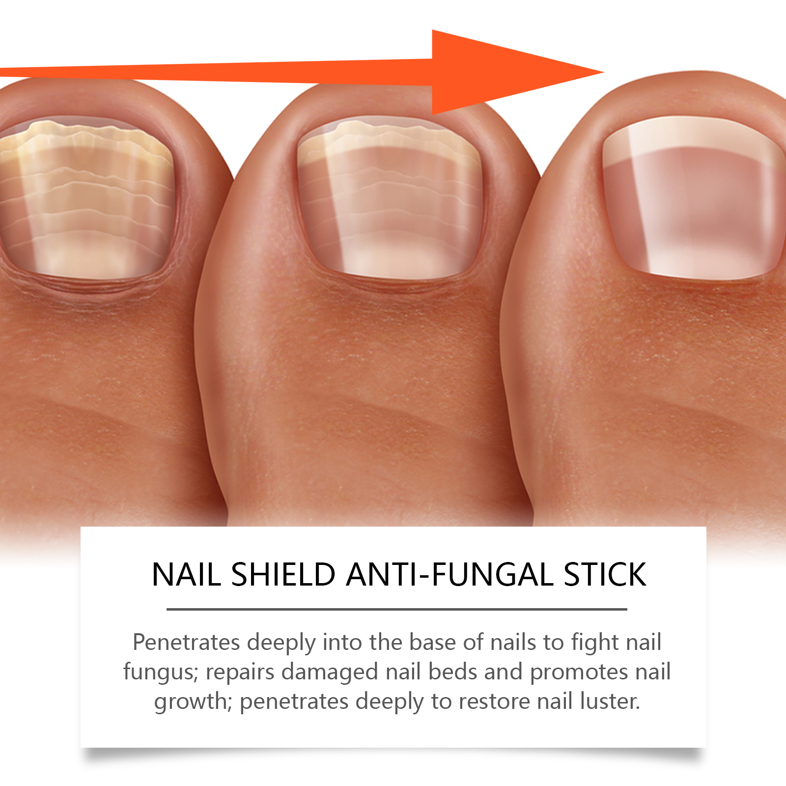 Nail Care Roller Stick Repair Nourish Portable Mild Skin Friendly Hand Foot Nail Surface Edge Hangnail Cracked Skin