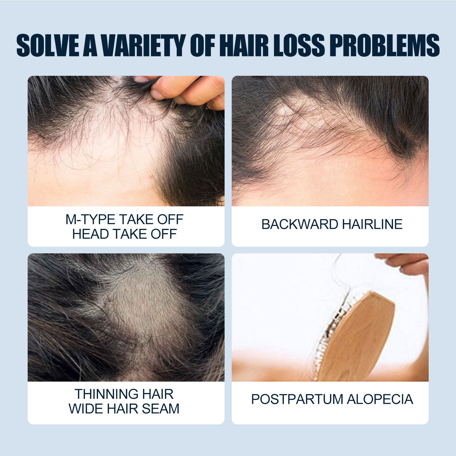 Hair Growth Solution Spray Hair Regrowth Thinning Serum Spray Hair Care Scalp Treatments Products for Stronger Thicker Longer Hair Anti Hair Loss 30ml