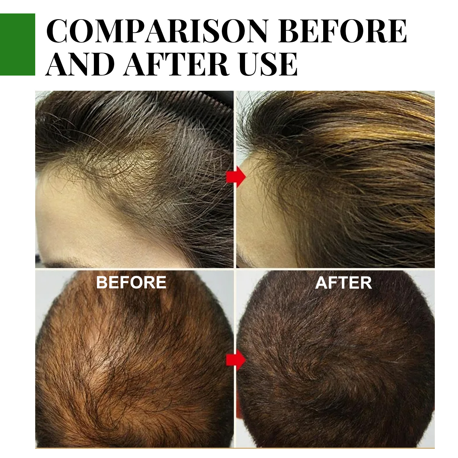 Rosemary Essential Oil Hair Care Serum Smooth Anti-frizz Growth Anti Hairs Loss Treatments 30ml