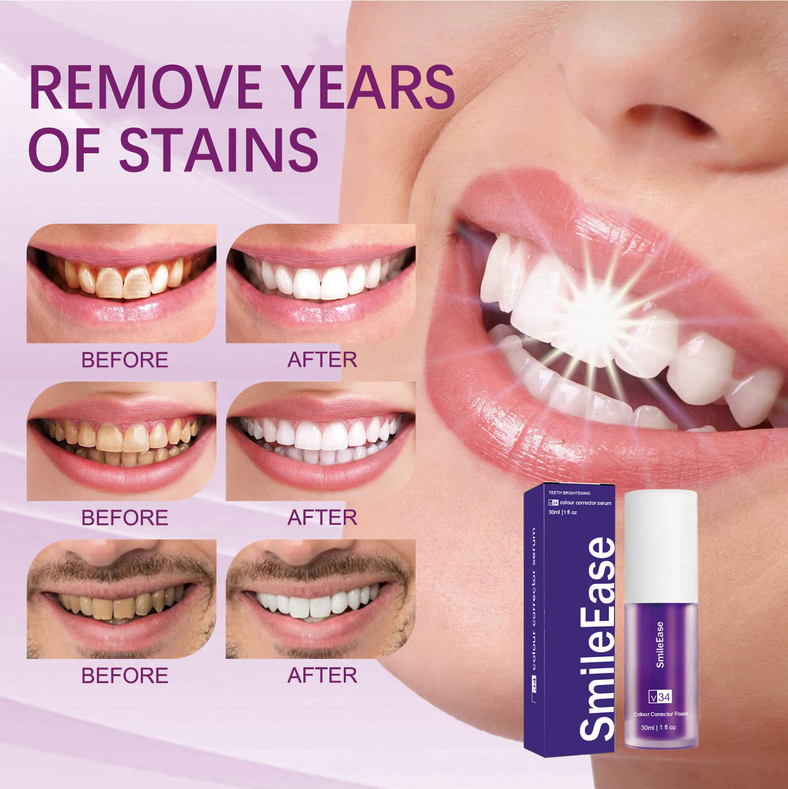 SmileEase V34 Colour Corrector Serum Tooth Whitening Purple Toothpaste Remove Tartar Repair Smoke Teeth Oral Health Care 30ml