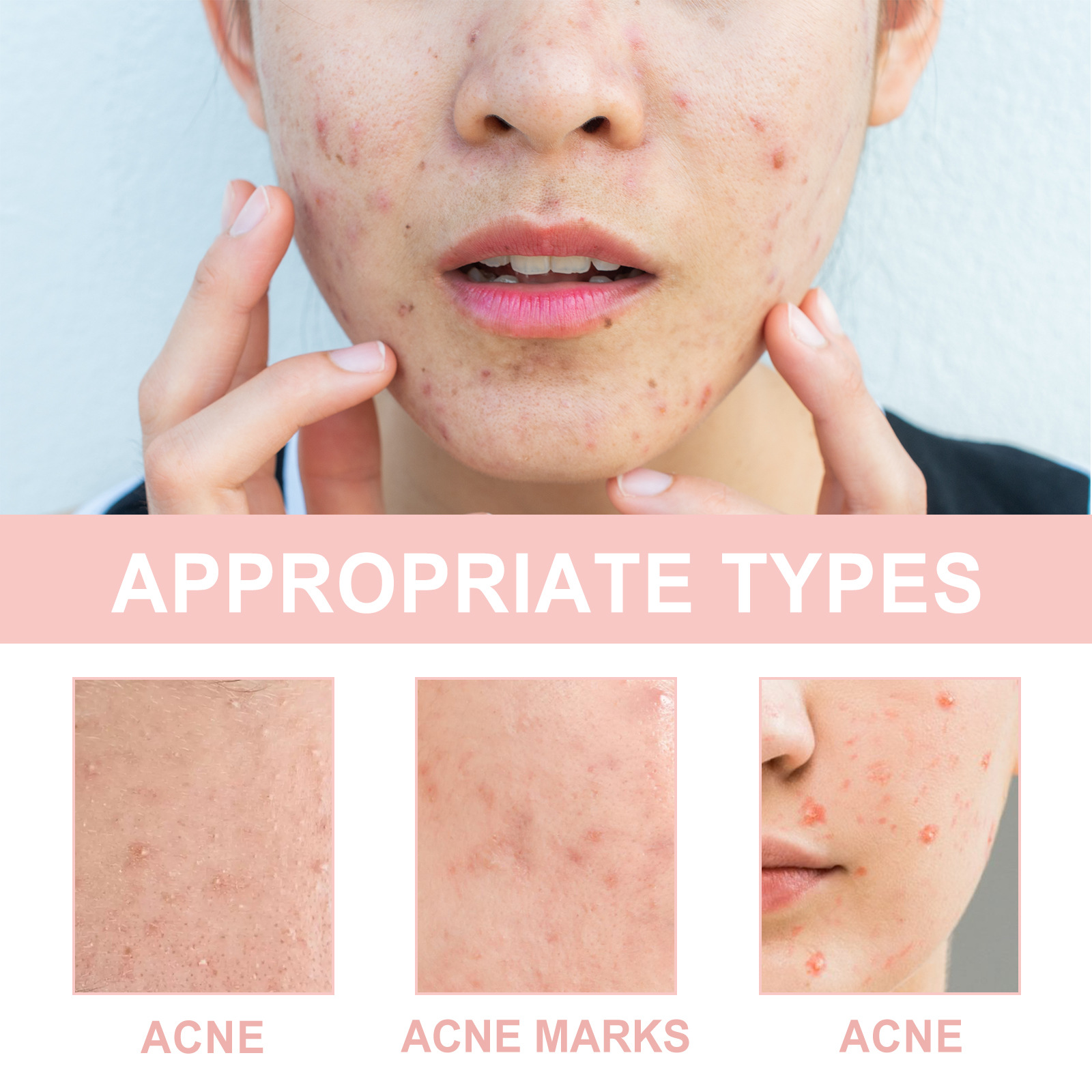 (1 PC) Face Patches For Pimples Microneedles Drying Patch Blemish Covering Repair Stickers Invisible Anti Acne Spots Marks Concealer Care Absorbing All Day