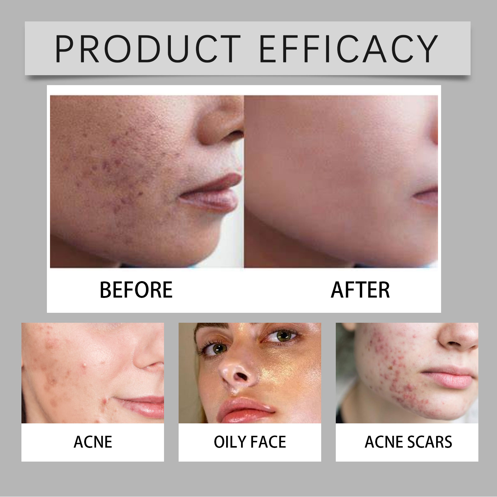 Moisturizing Essence Liquid Mild Hydrating Nourishing Soft Tender Care Daily Facial Skin Maintenance